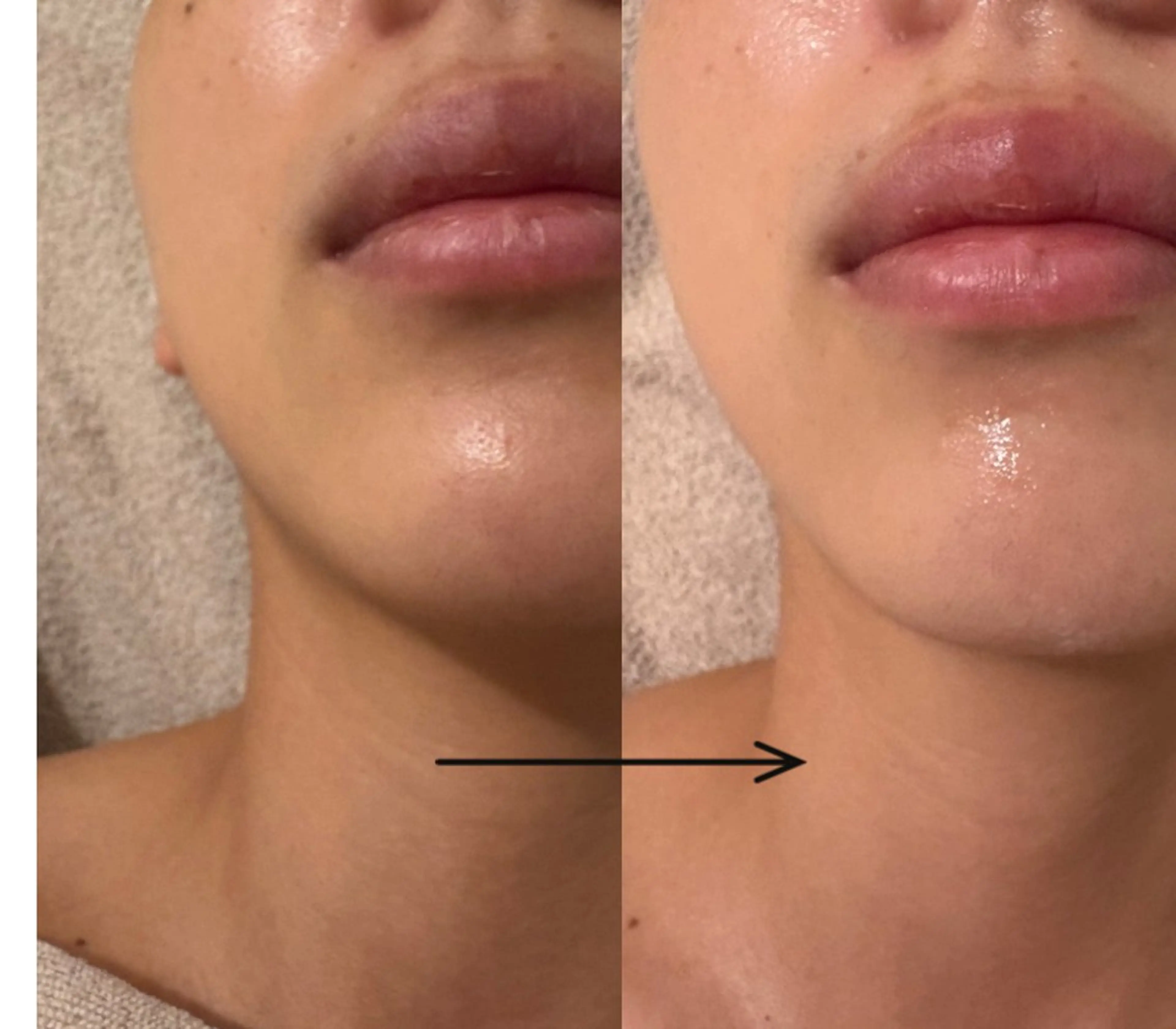 UEDA | POLA 天王寺のエステ・リラクイメージ