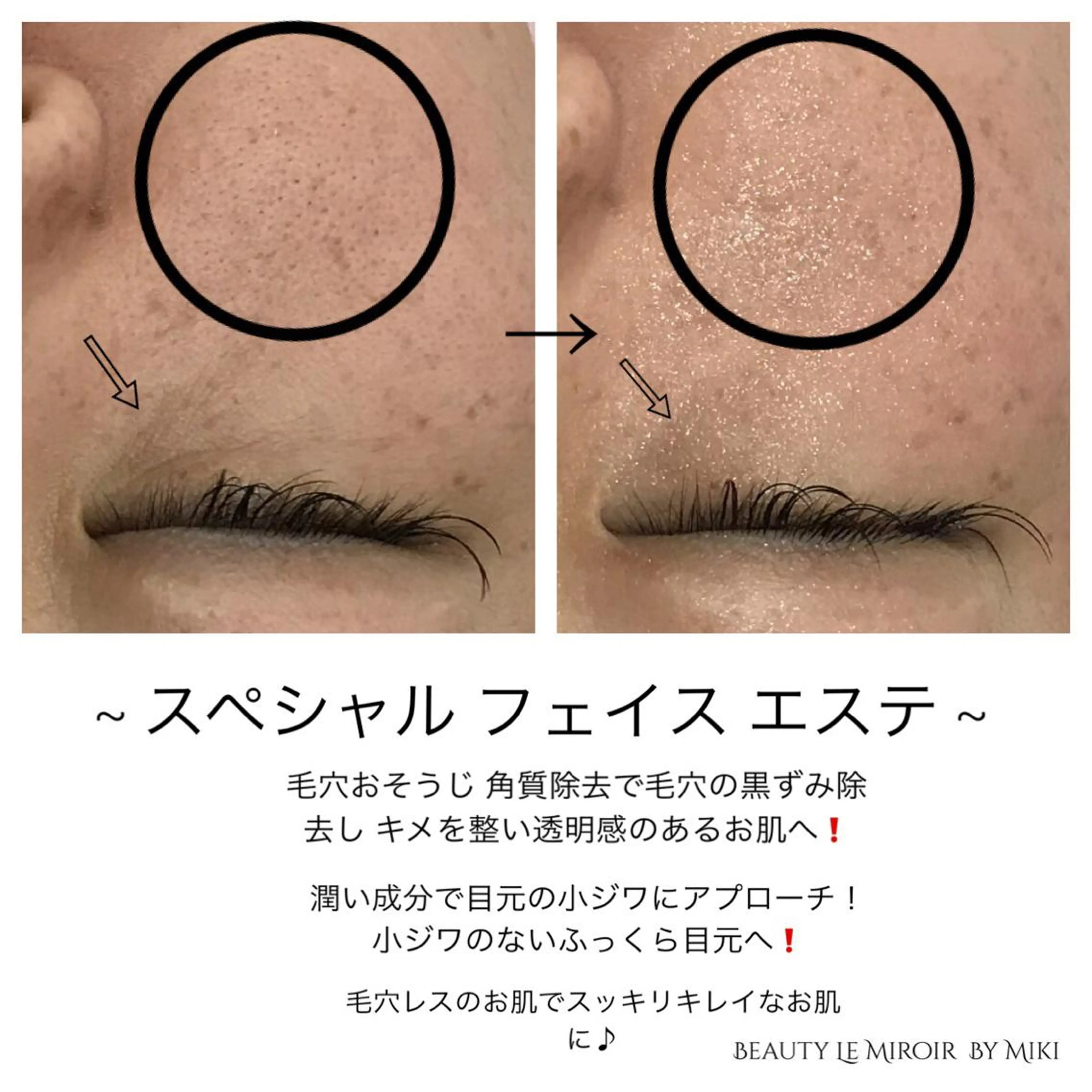 ビューティー ミロワールのエステ・リラクイメージ