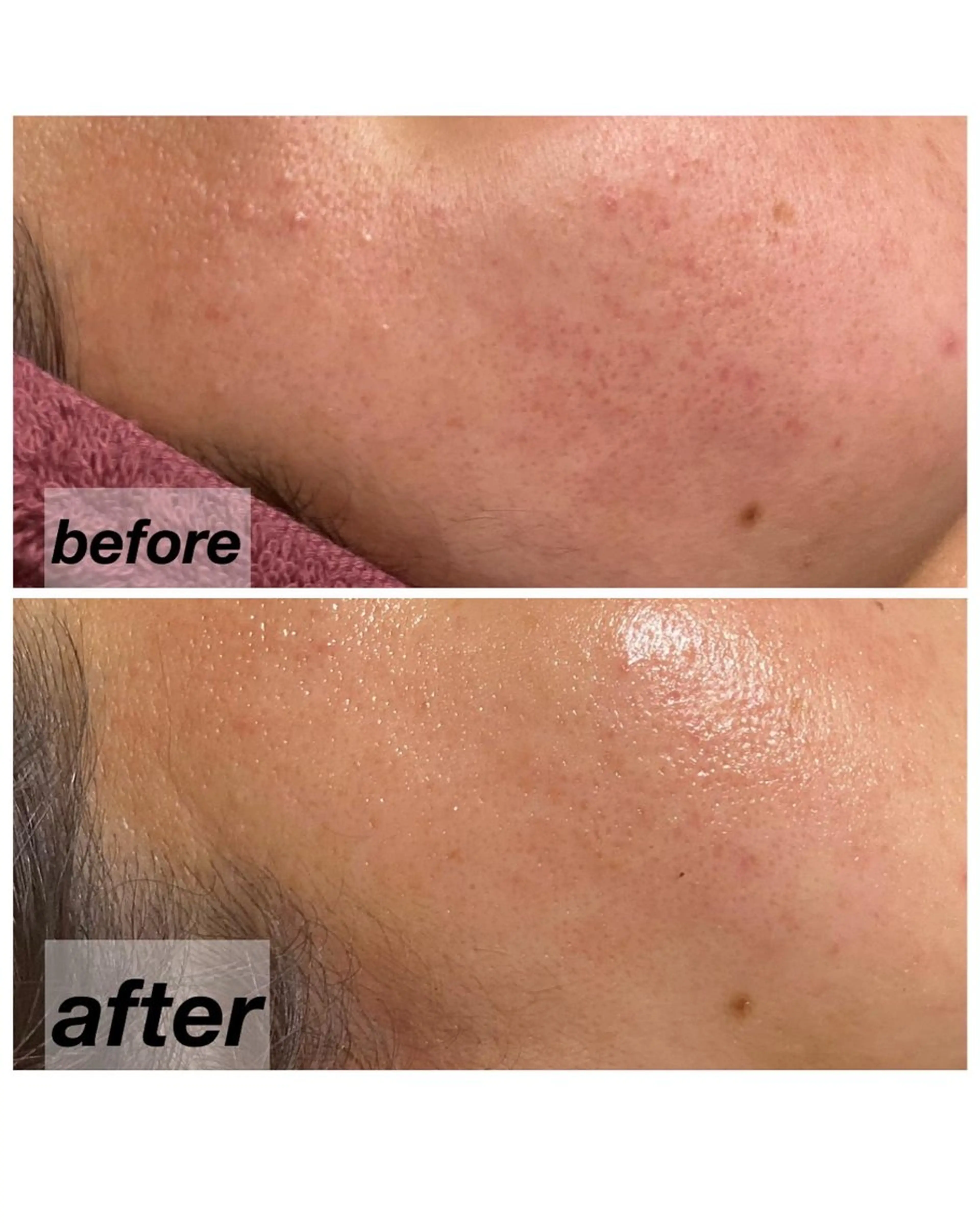 越猪 未来のネイルデザイン