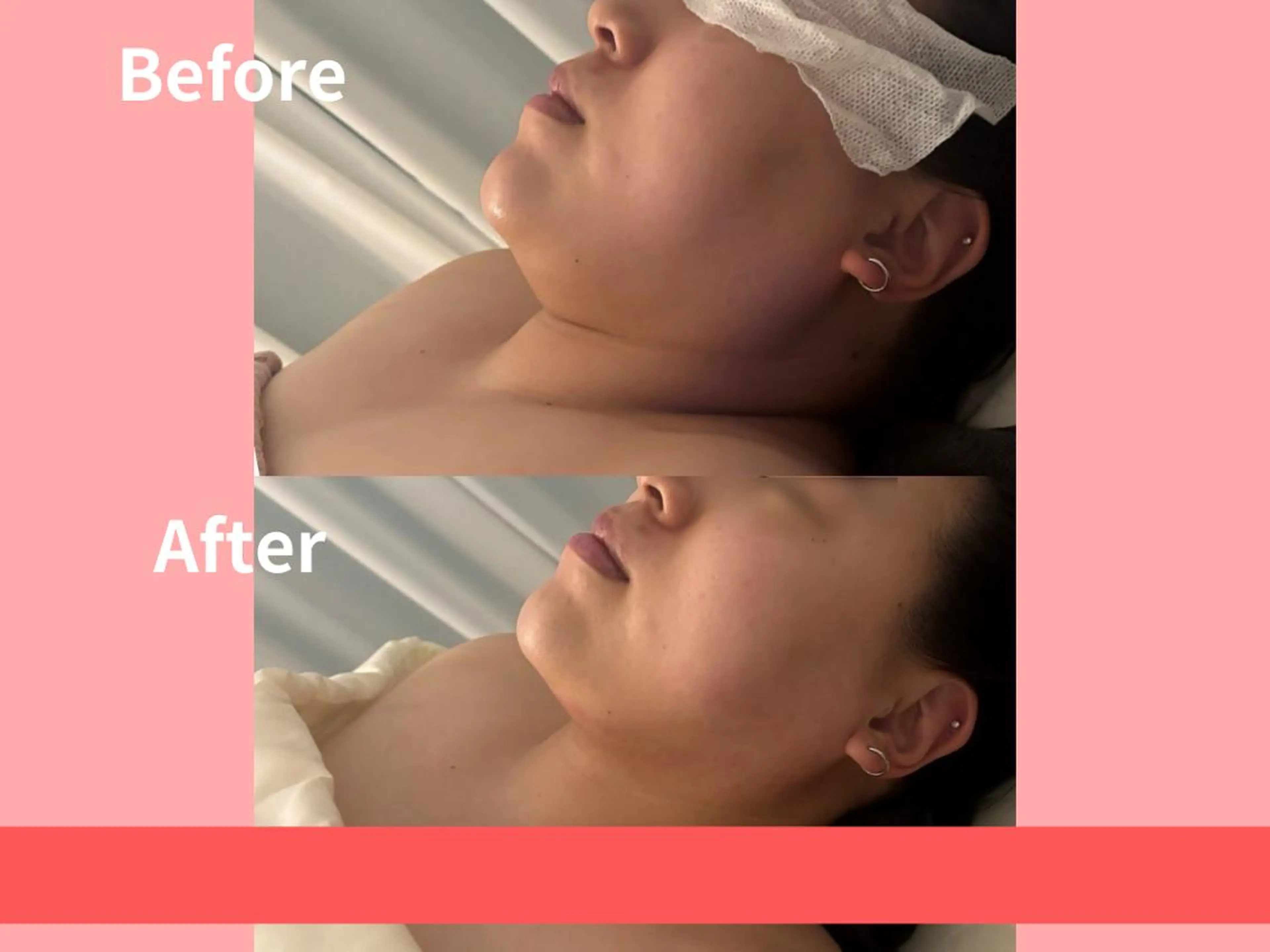 痩身Relives 金町店のその他イメージ