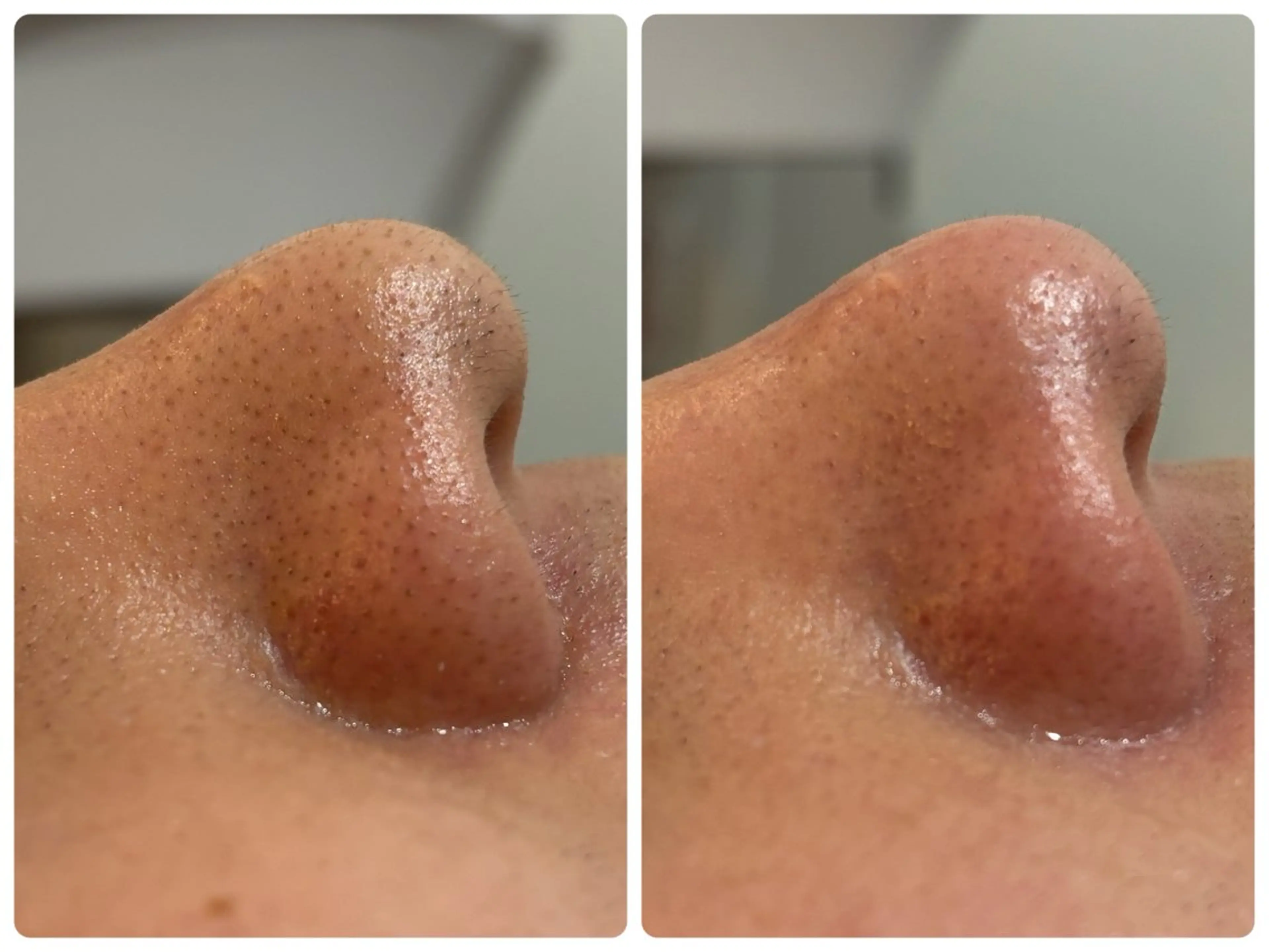 プライベートサロン Lokahi  鮫島のエステ・リラクイメージ