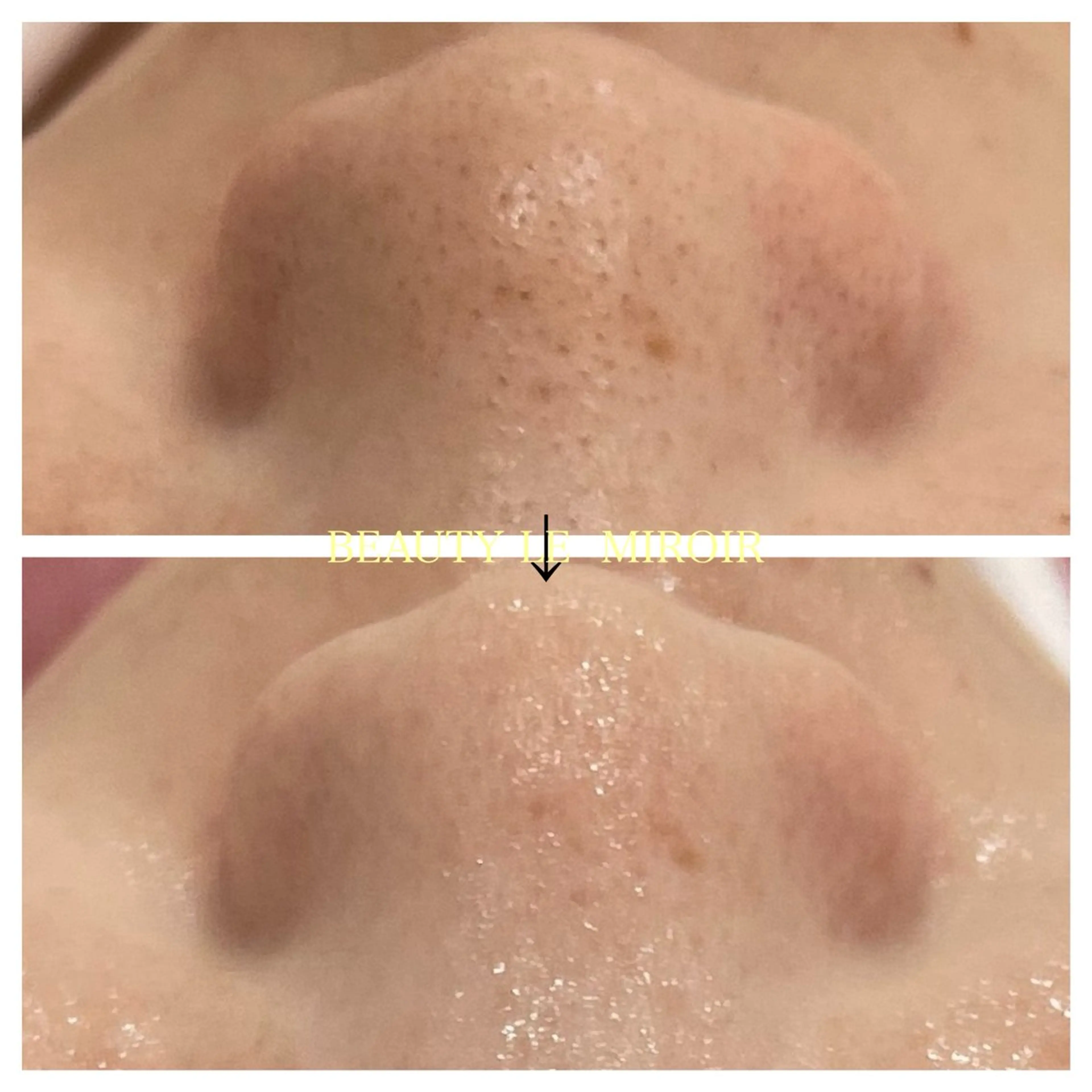 エステ ビューティー ミロワールのエステ・リラクイメージ