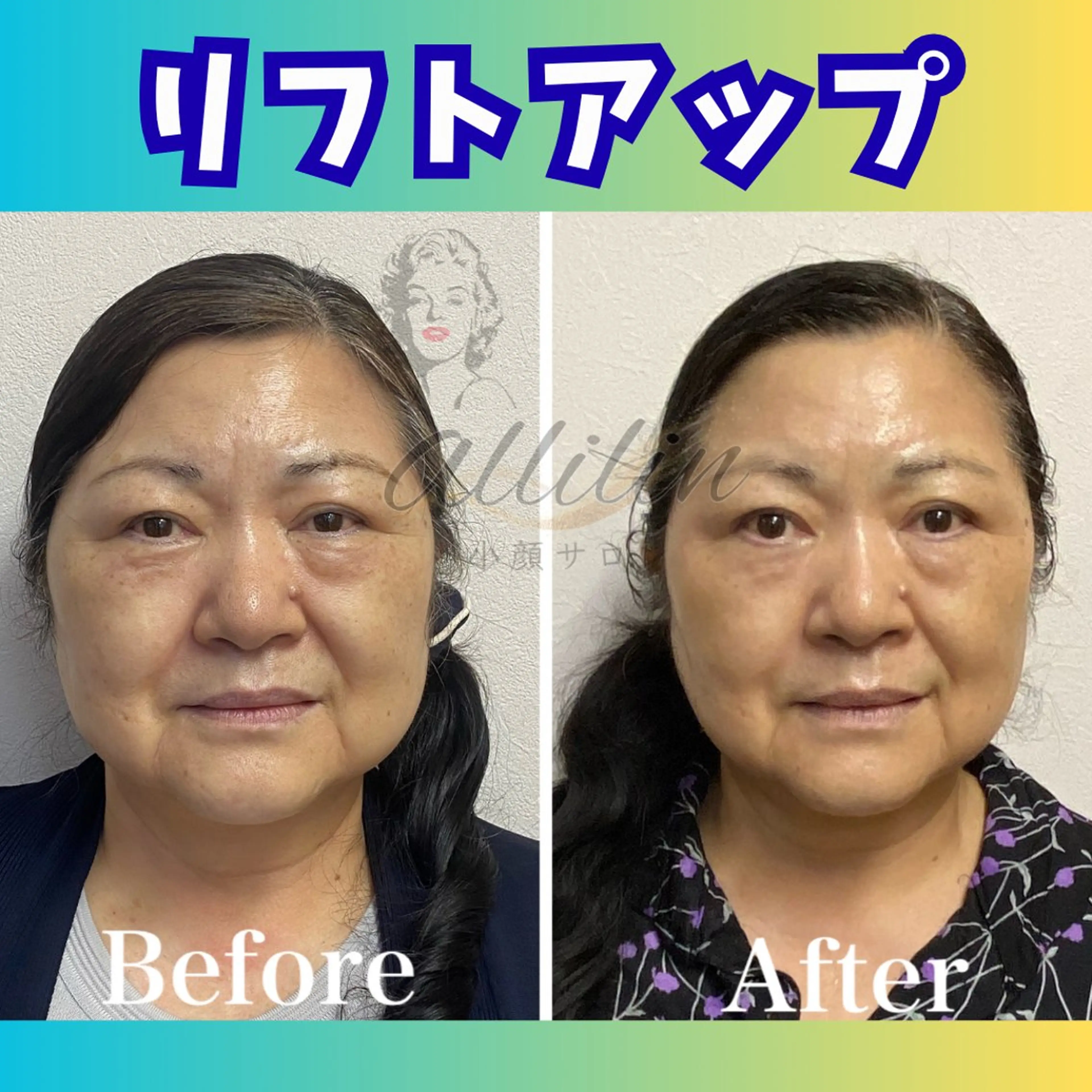 💎小顔ｻﾛﾝ アリリン銀座💎のエステ・リラクイメージ