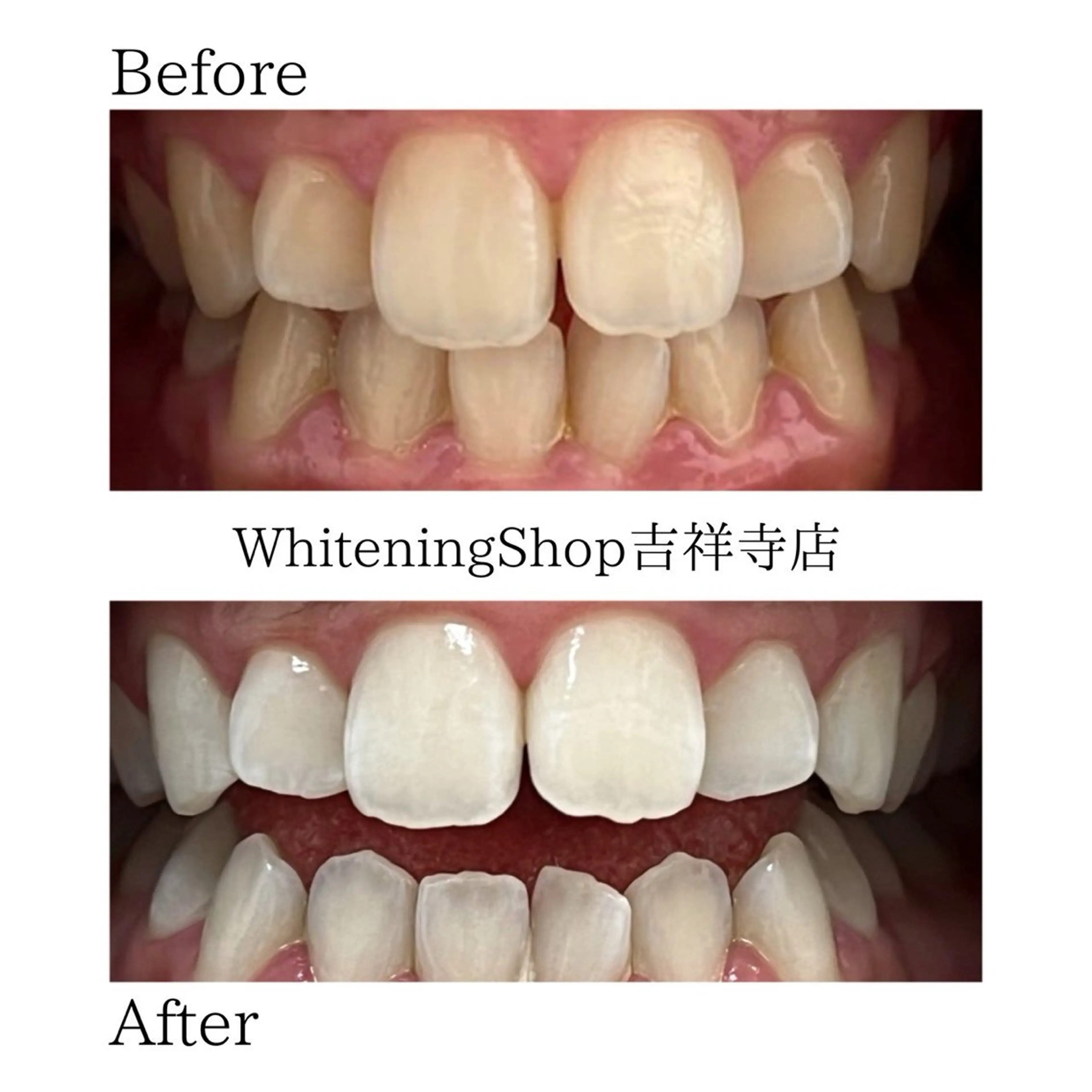 エステ リラク ホワイトニング ショップ吉祥寺店のエステ・リラクイメージ