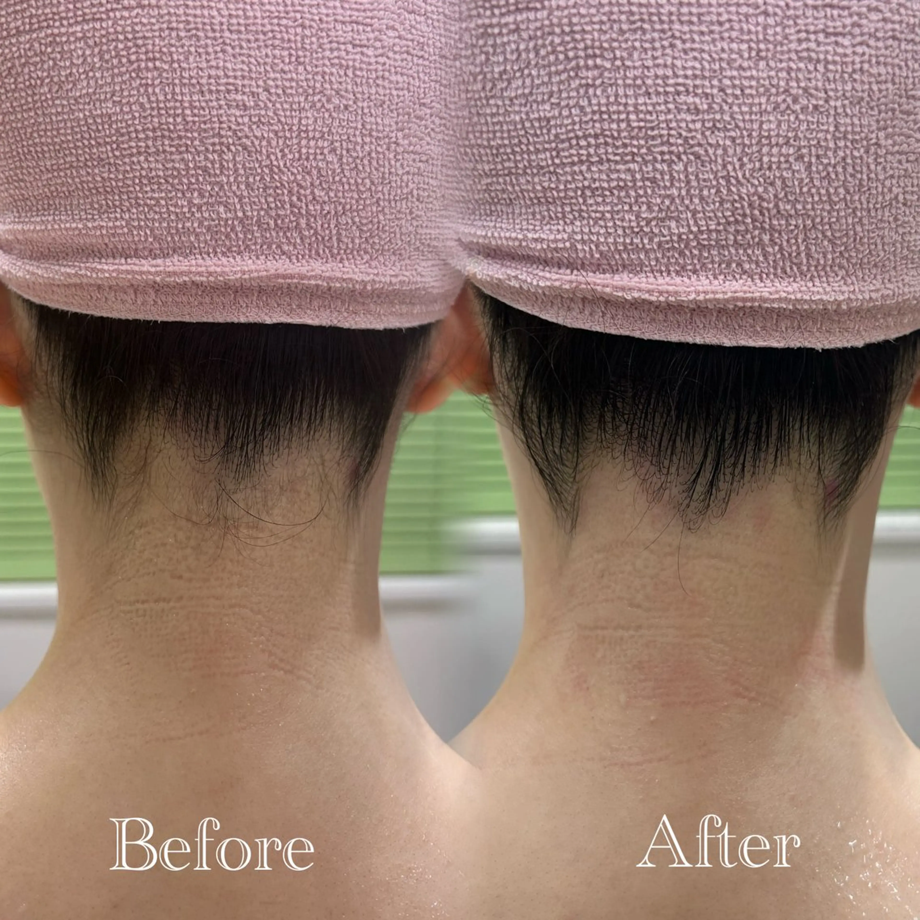 🫧美しい素肌へ🫧 今成柚乃のその他イメージ