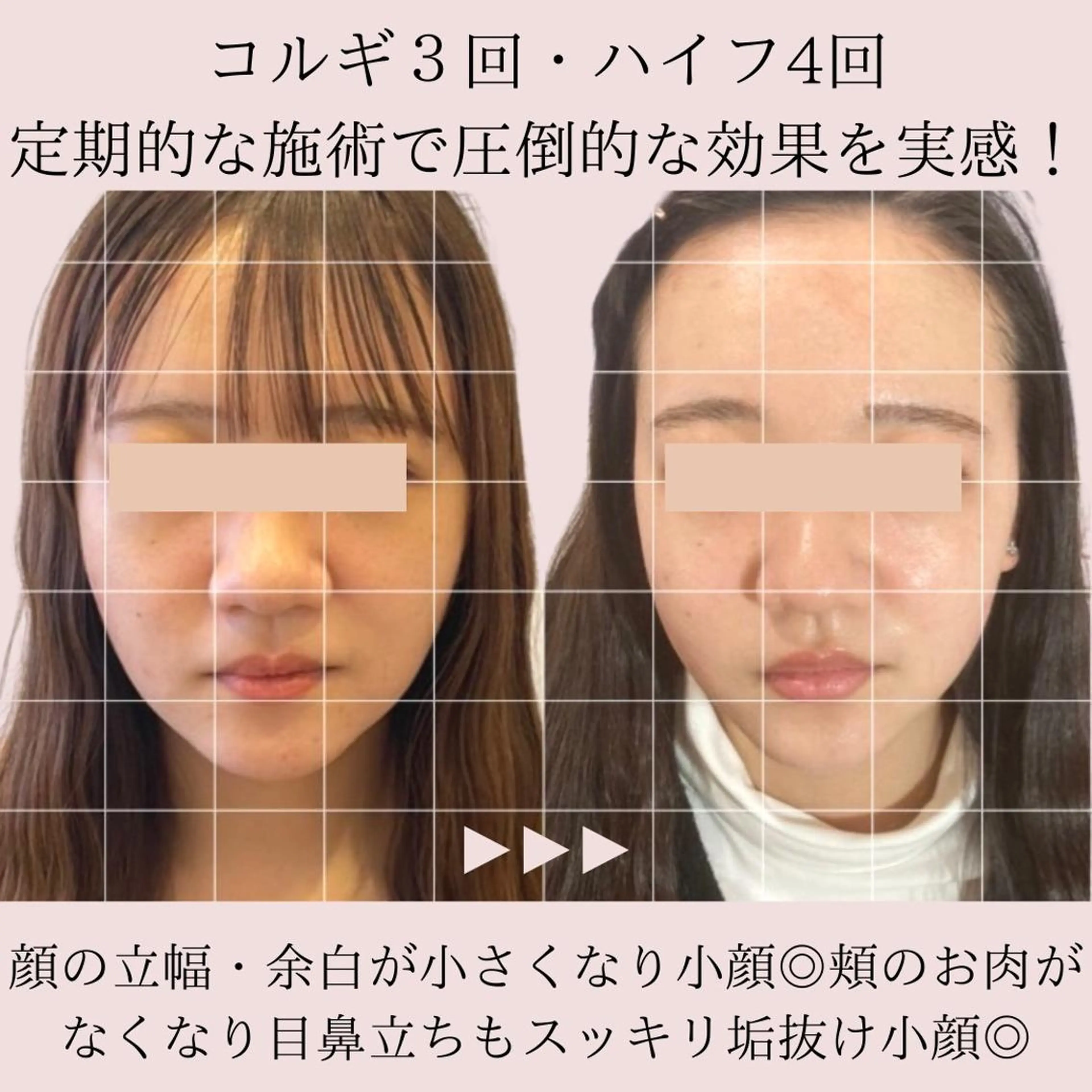 第一印象専門サロン ADISEのエステ・リラクイメージ