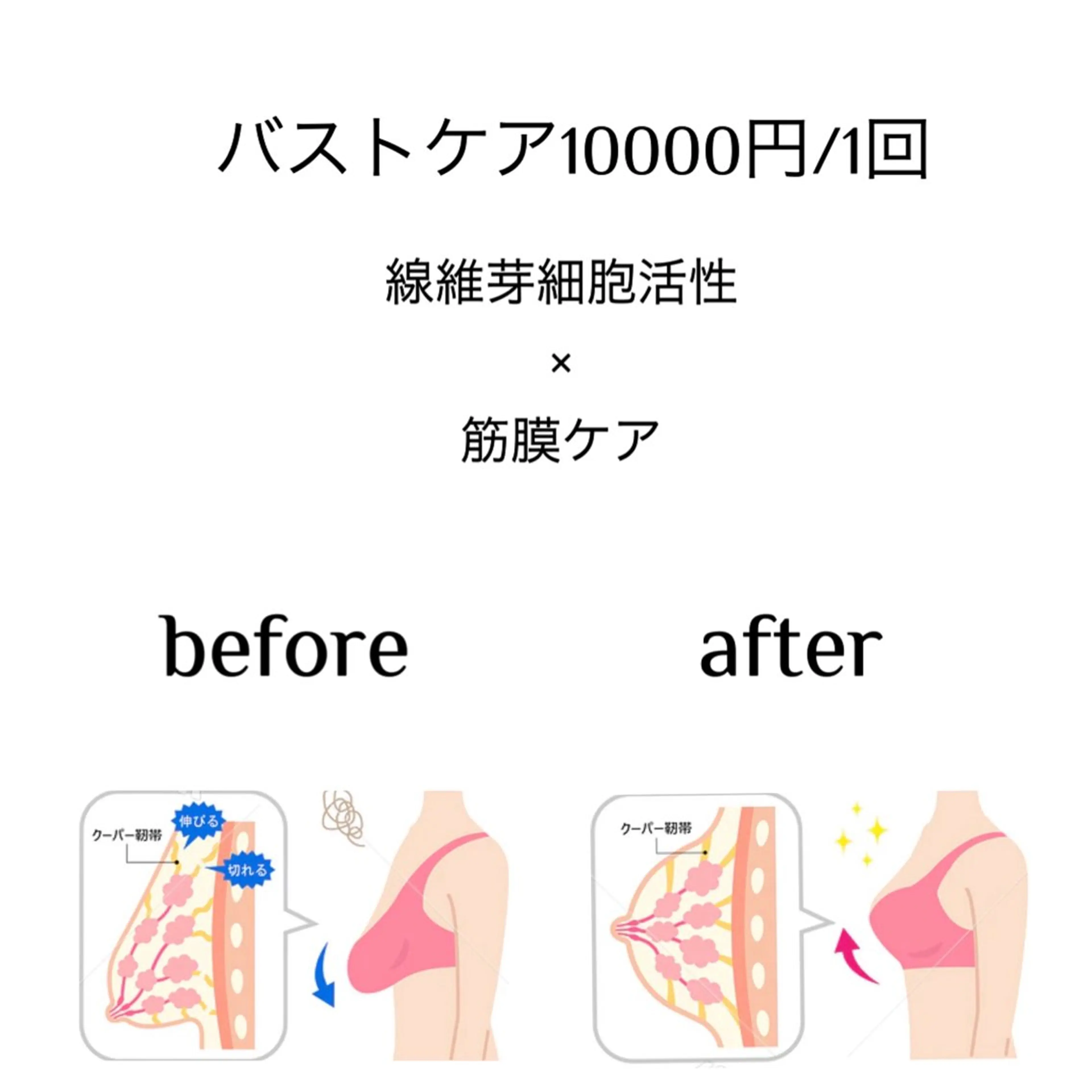 バストケア10000円/1回　（線維芽細胞活性×筋膜ケア）の写真