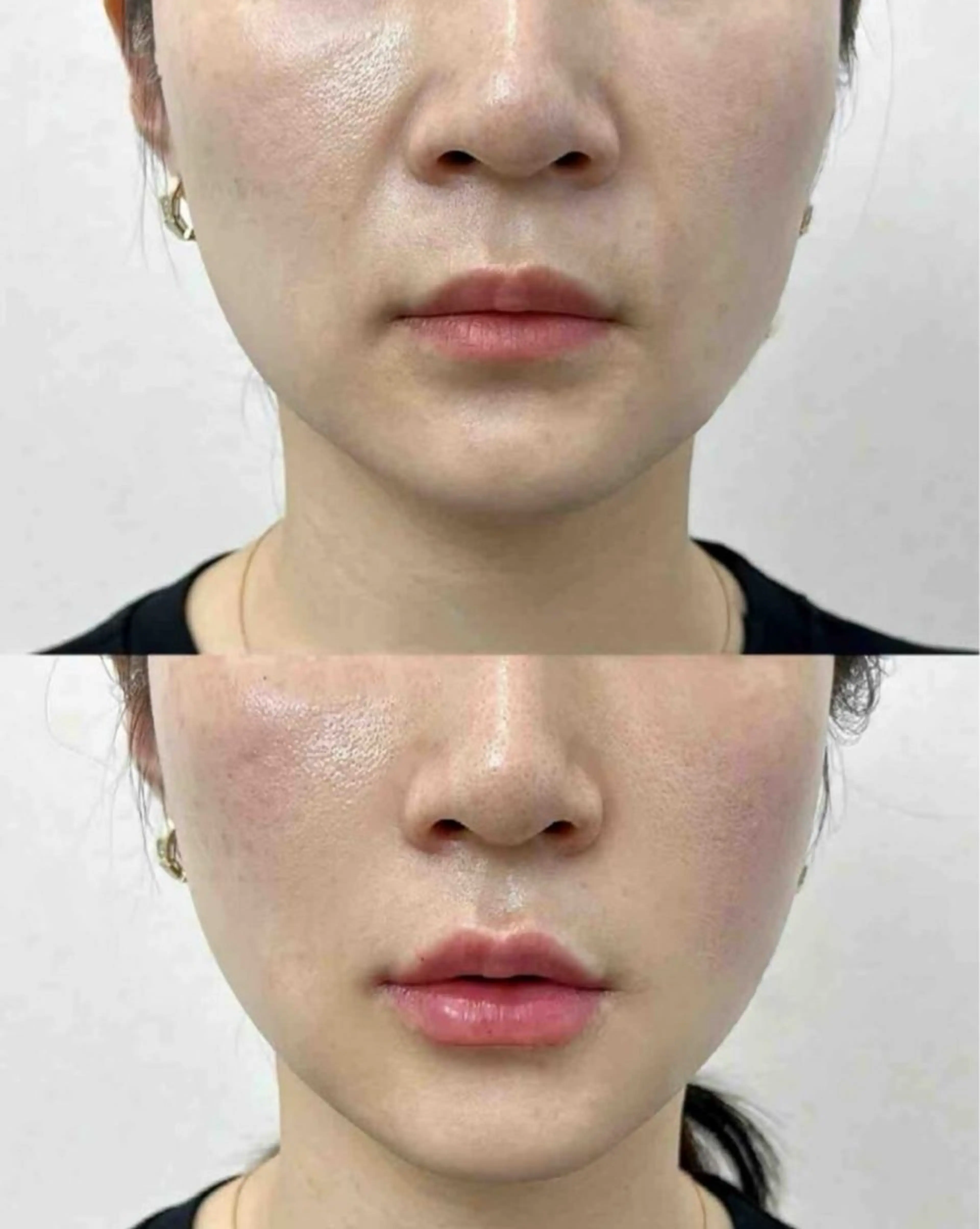 マツエク・マツパ エステ リラク 愛維美水光美肌専門店 メンズレディースokのエステ・リラクイメージ