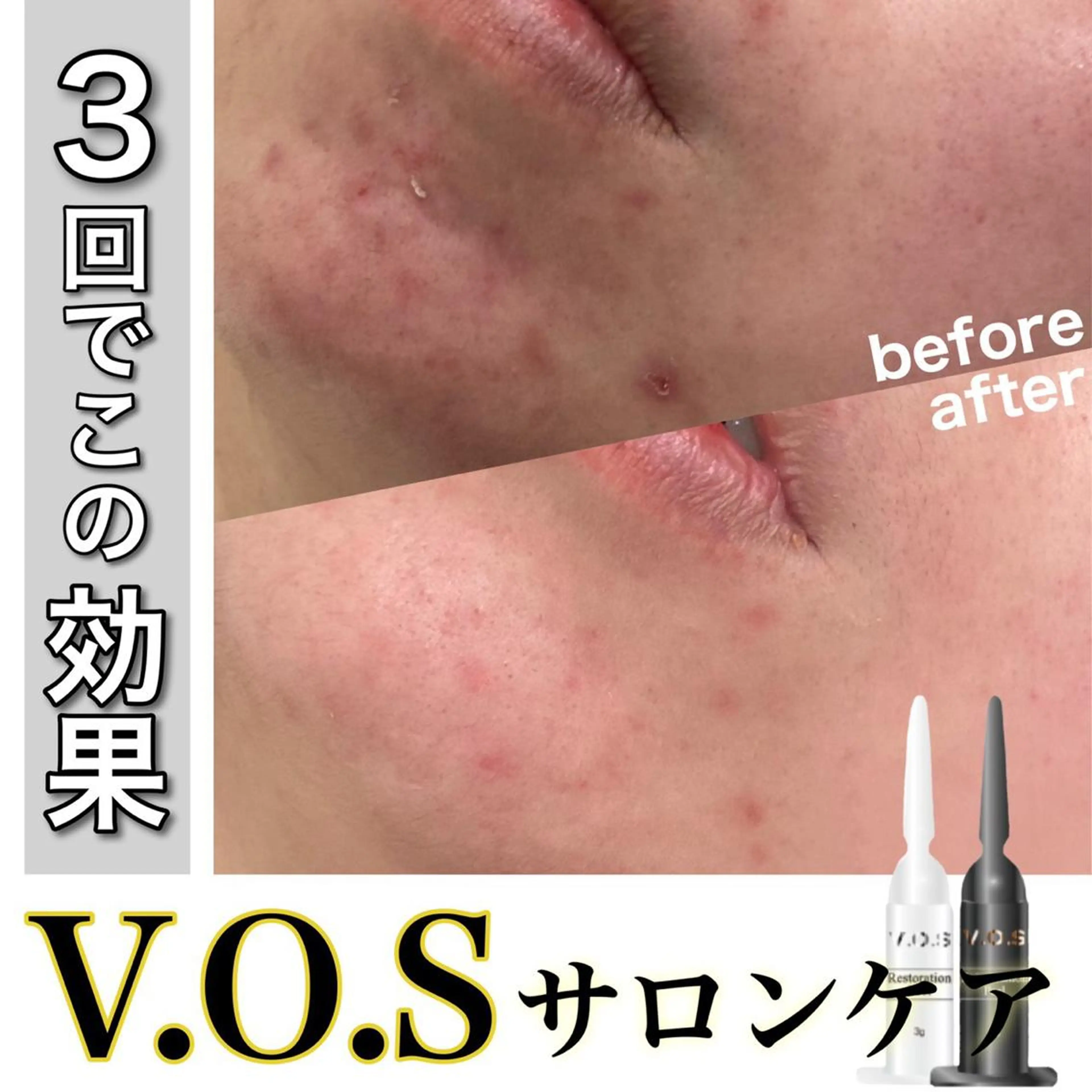 laluna saki...のその他イメージ