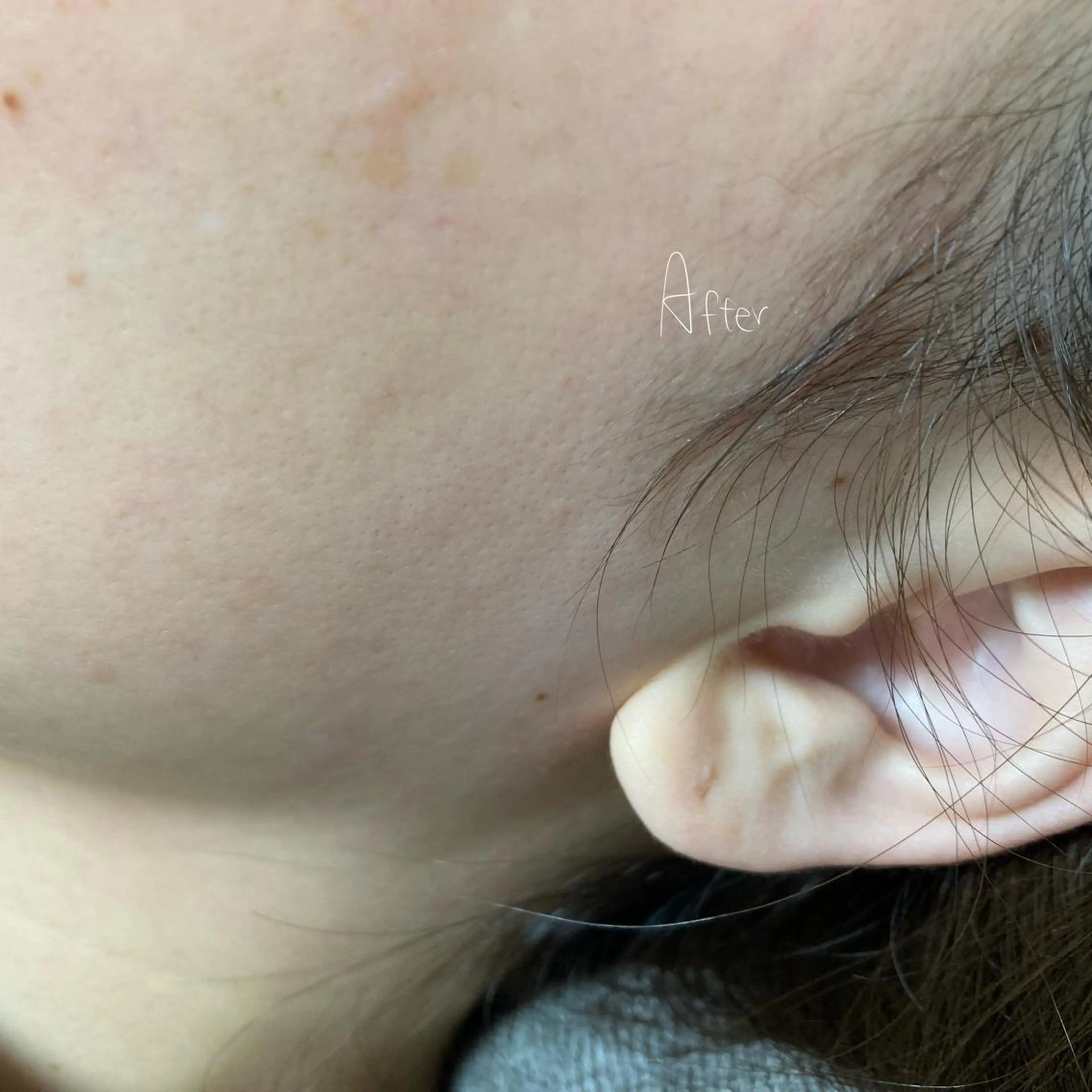 脱毛 Ohata Megumiの眉毛・アイブロウイメージ