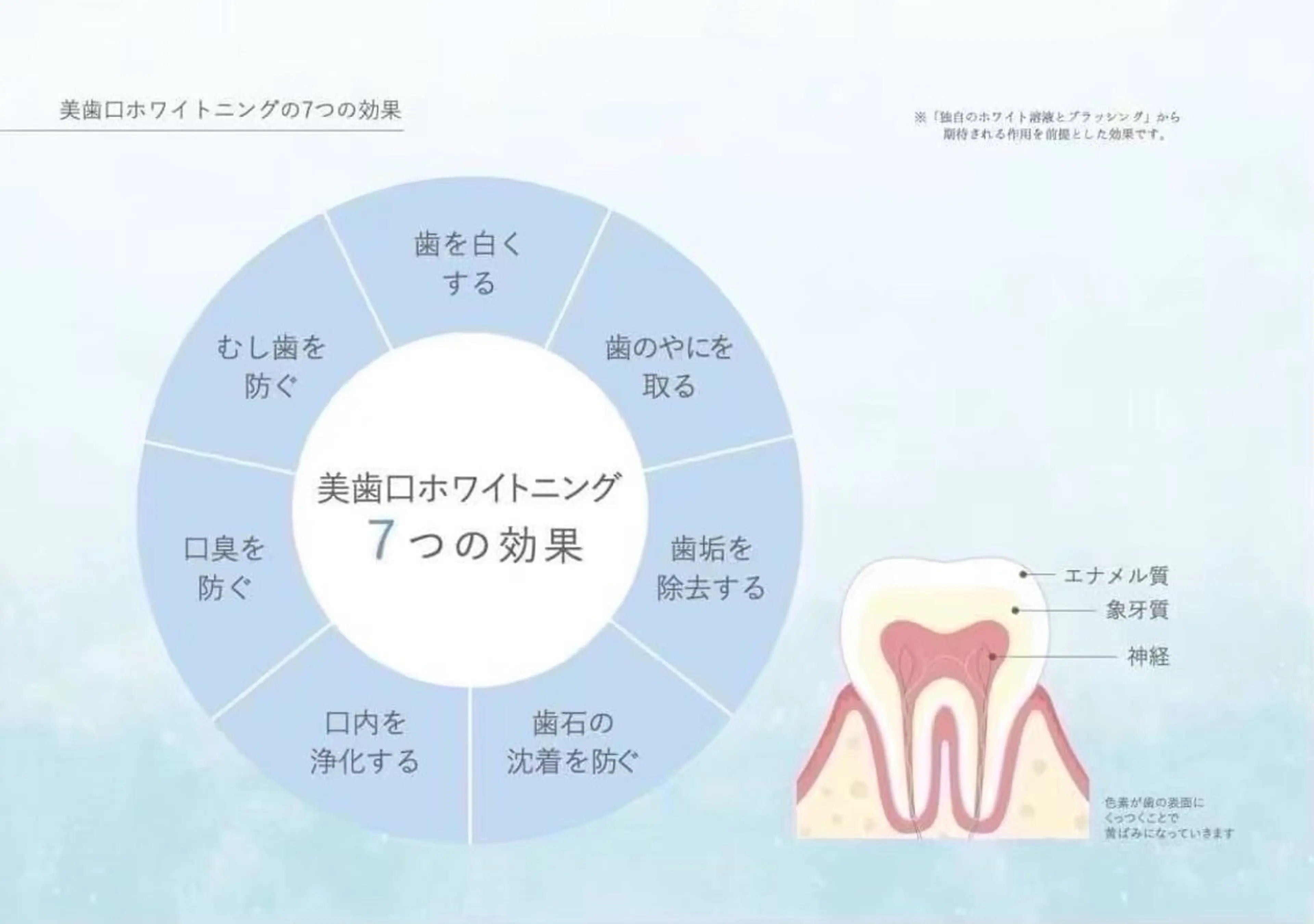 その他 ルミナホワイト セルフホワイトニングのその他イメージ