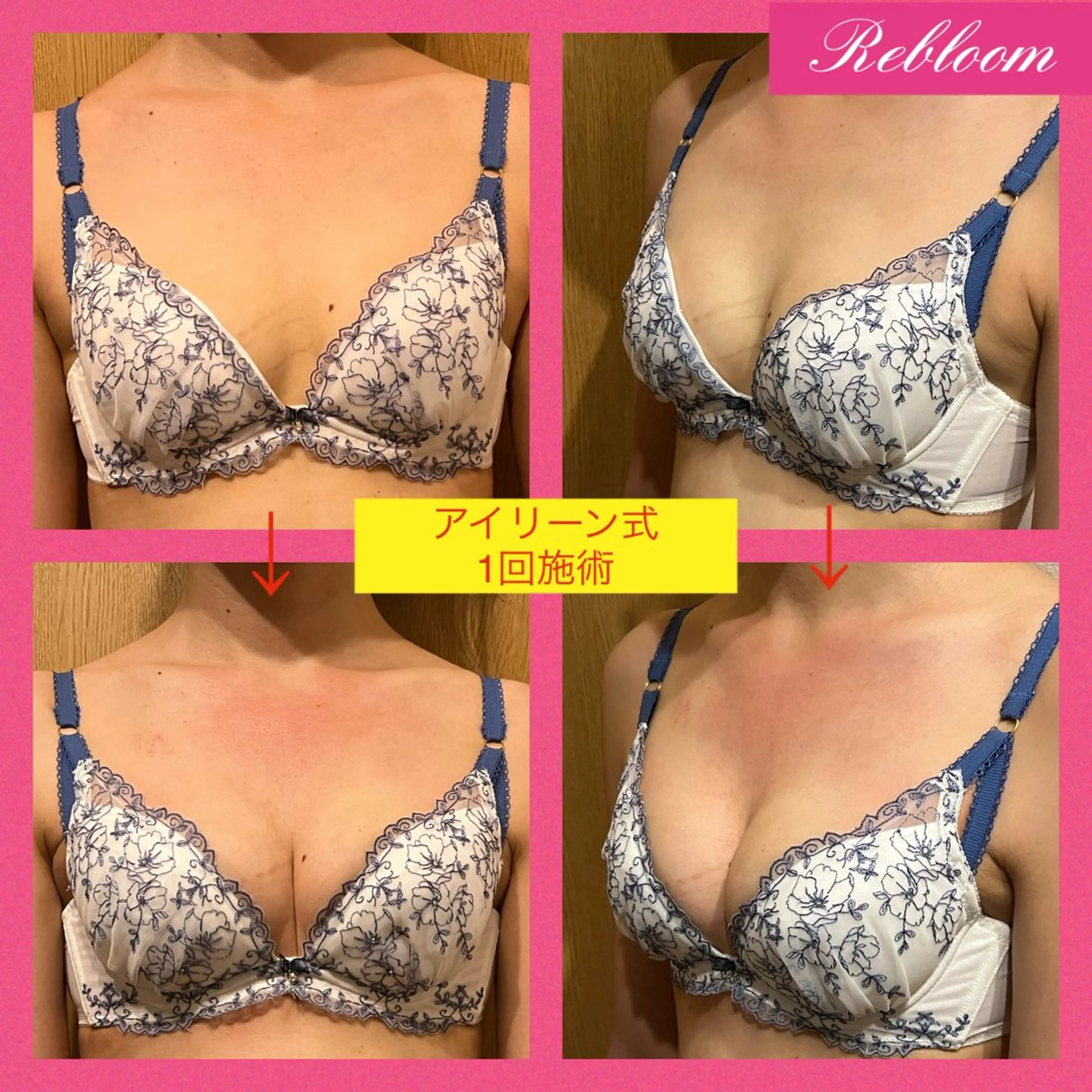 エステ デリケートな悩み解決 Rebloomのエステ・リラクイメージ