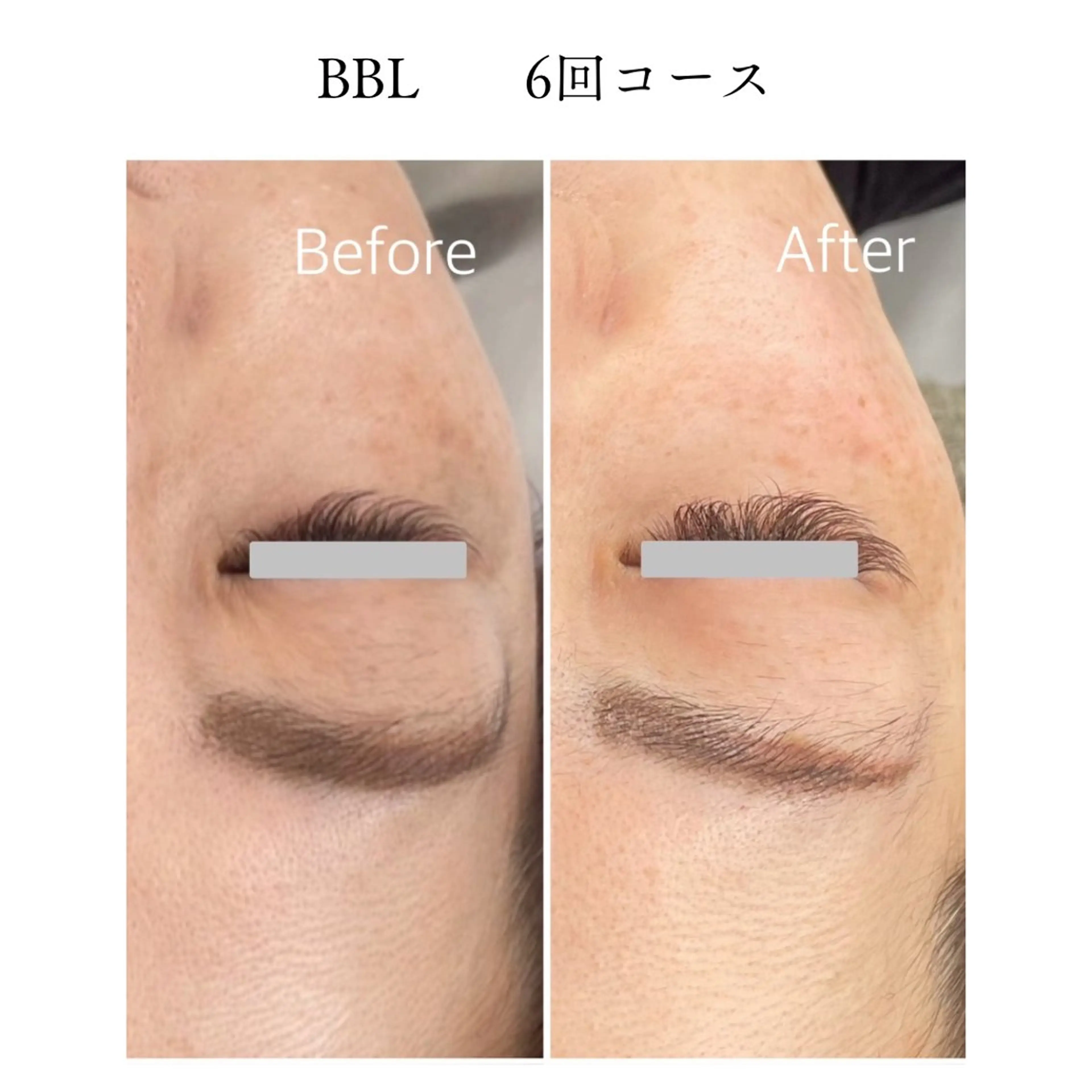 エステ TiALASH Estheticのエステ・リラクイメージ