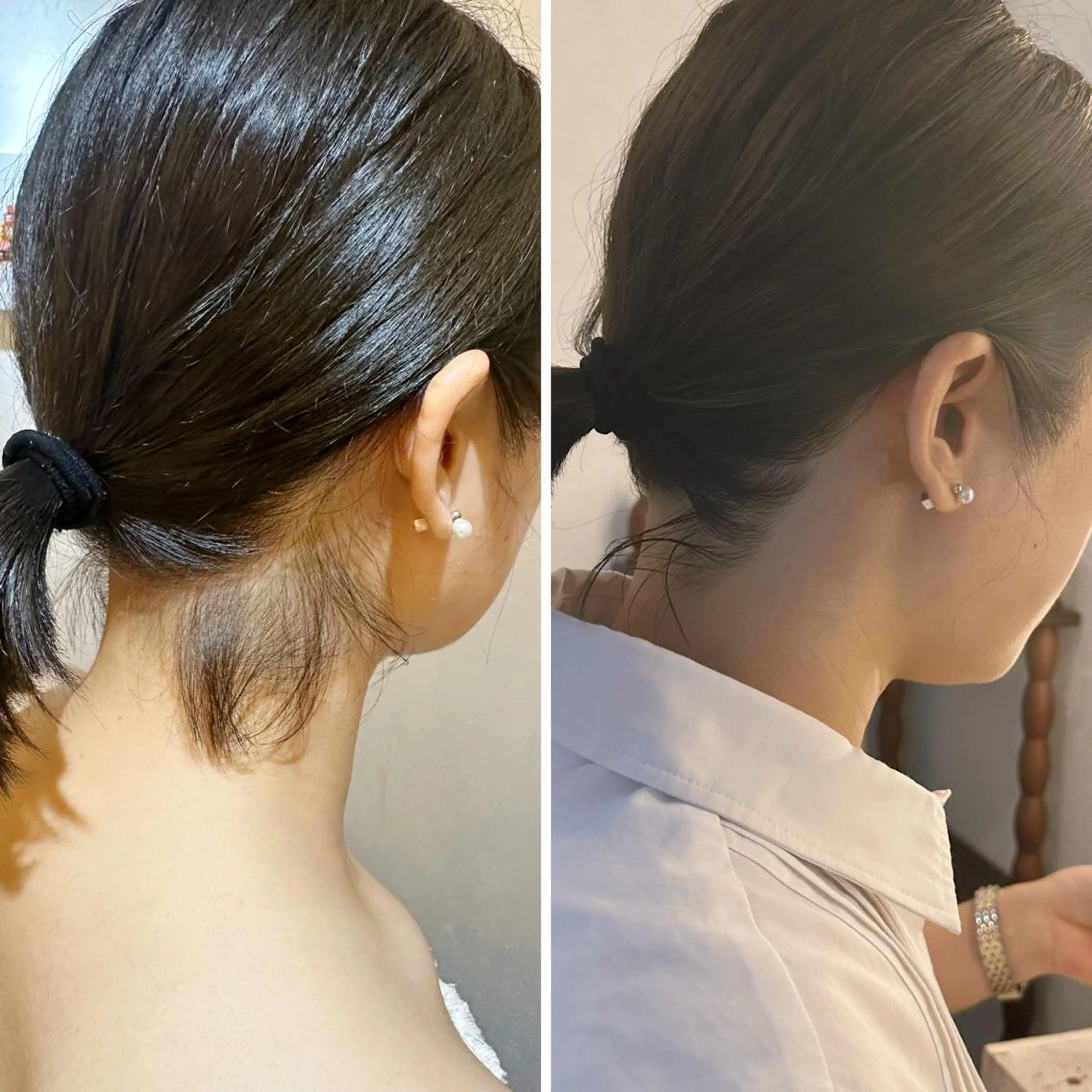 脱毛 うなじ脱毛/美肌脱毛 LABELのエステ・リラクイメージ