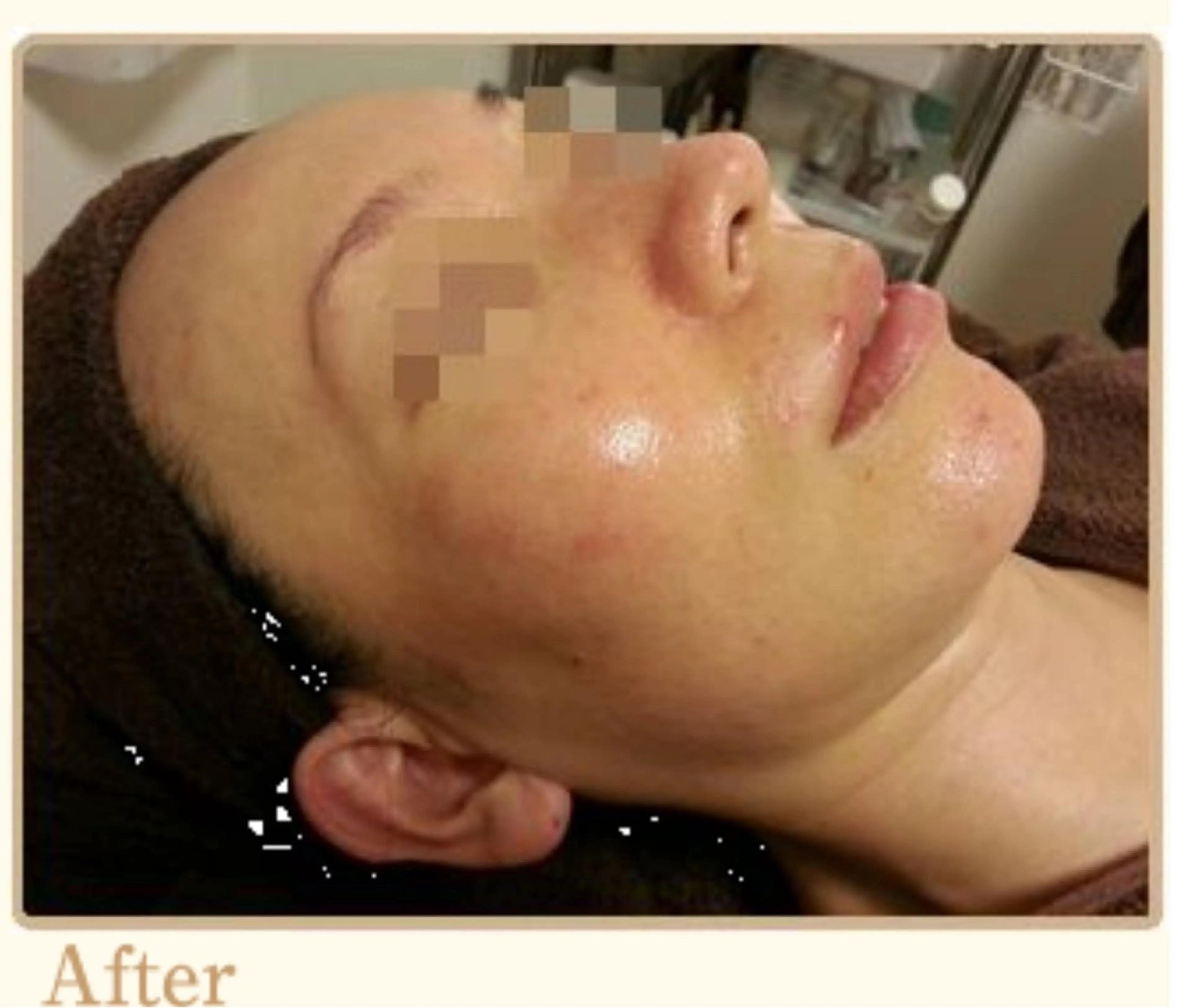 ピーリングサロン シャンテールのエステ・リラクイメージ