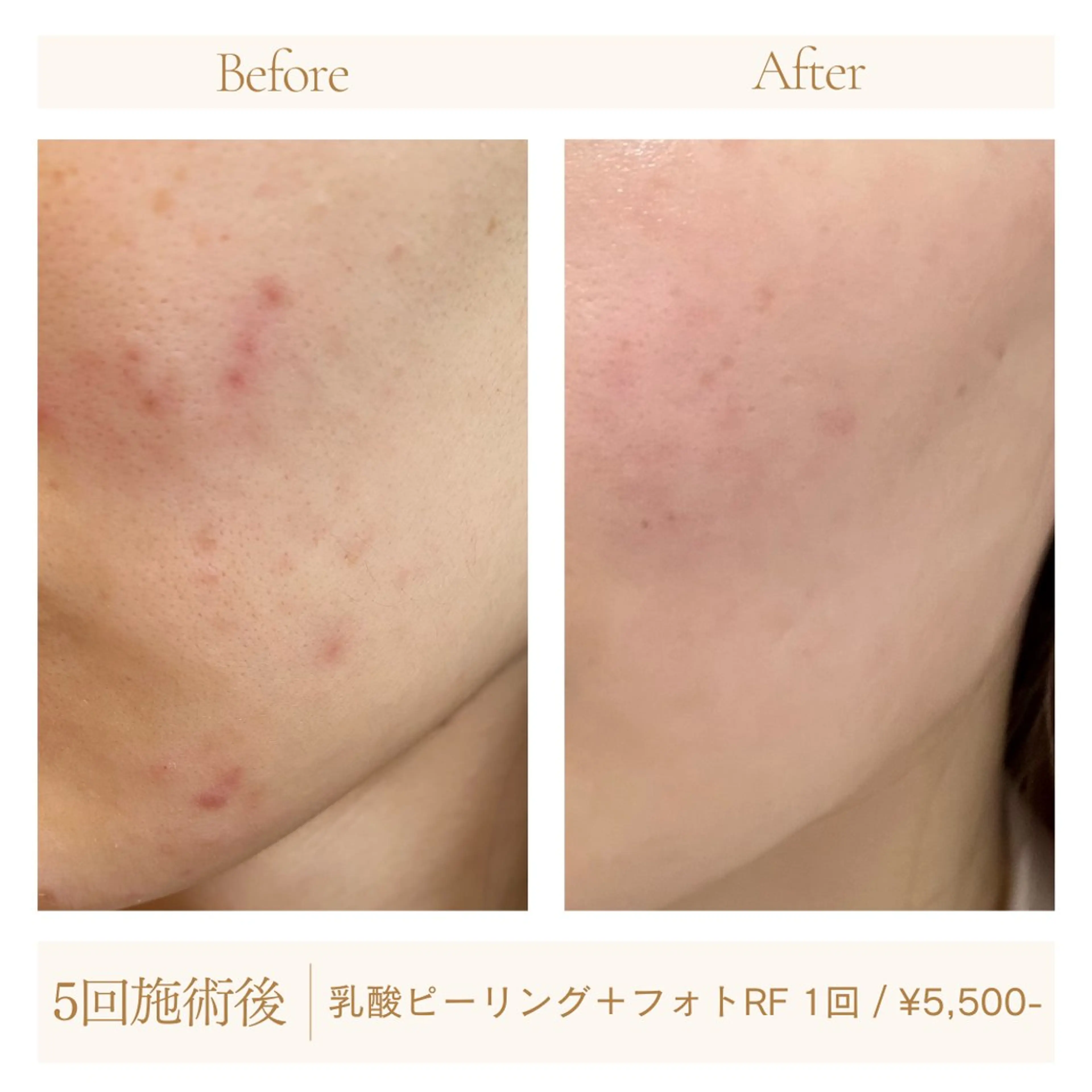 MiLACO❁ 【ミラコ】の眉毛・アイブロウイメージ