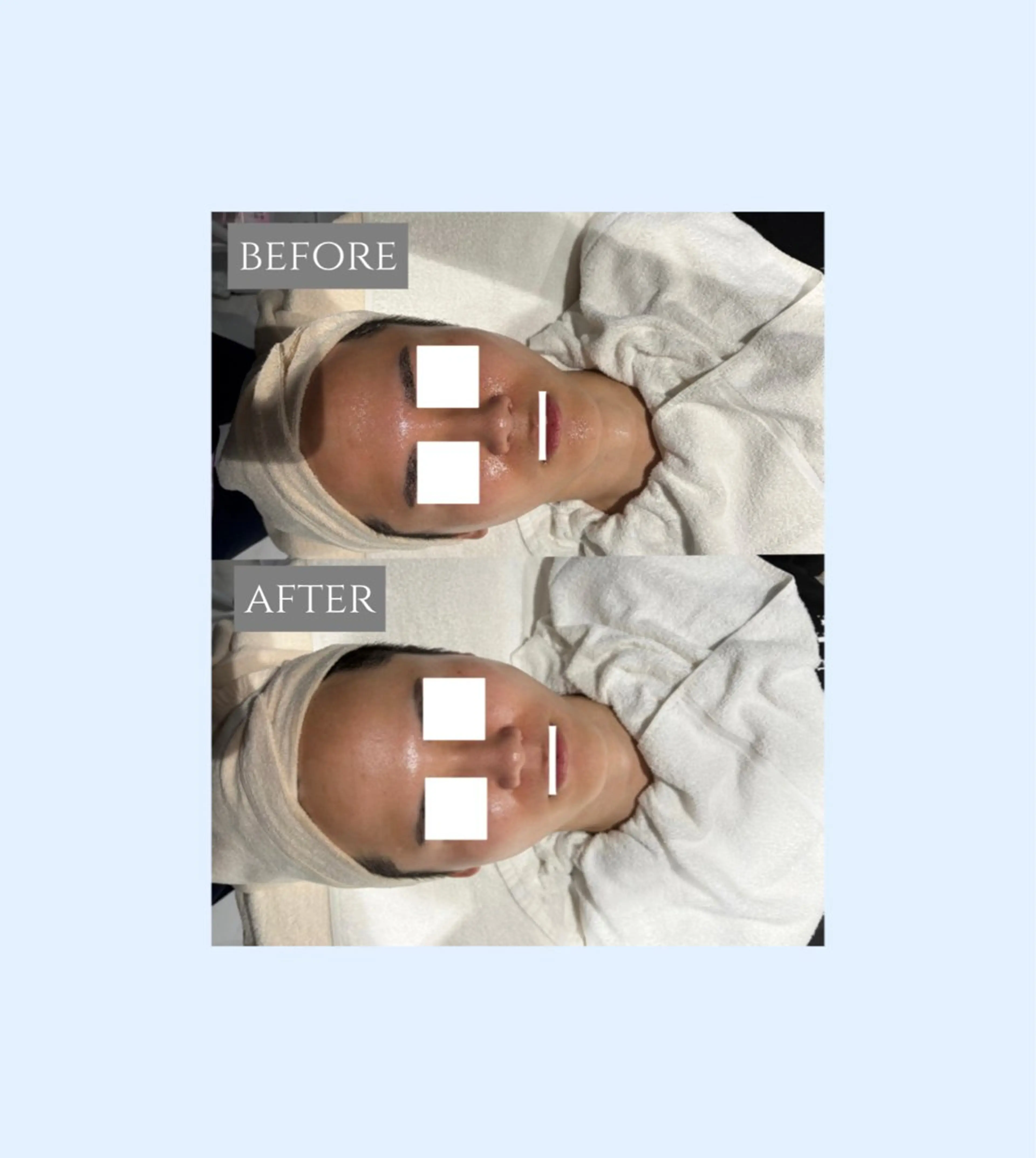 エステ 🎀肌質改善🫧 小山のエステ・リラクイメージ