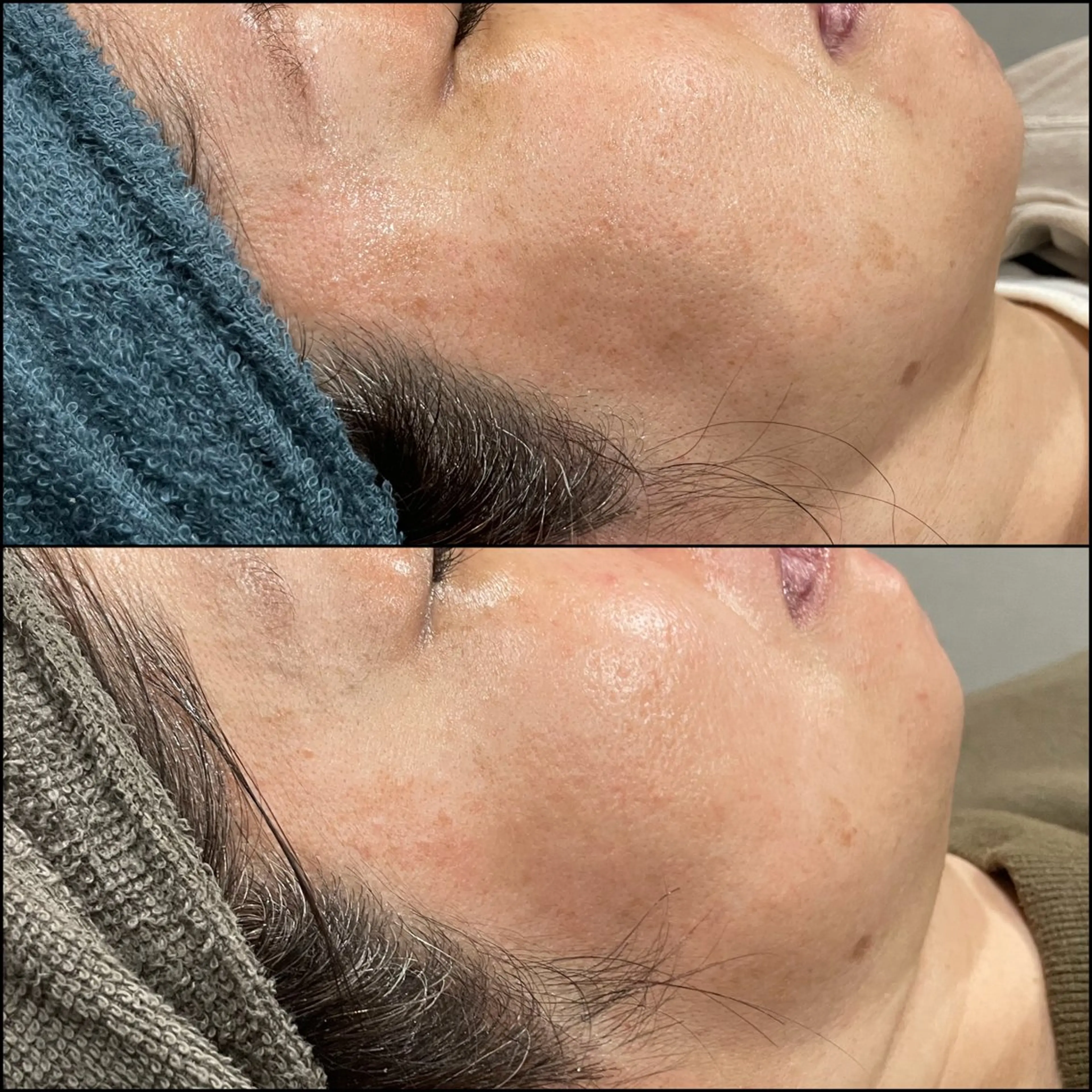 エステ LiZA エステティックサロンのエステ・リラクイメージ