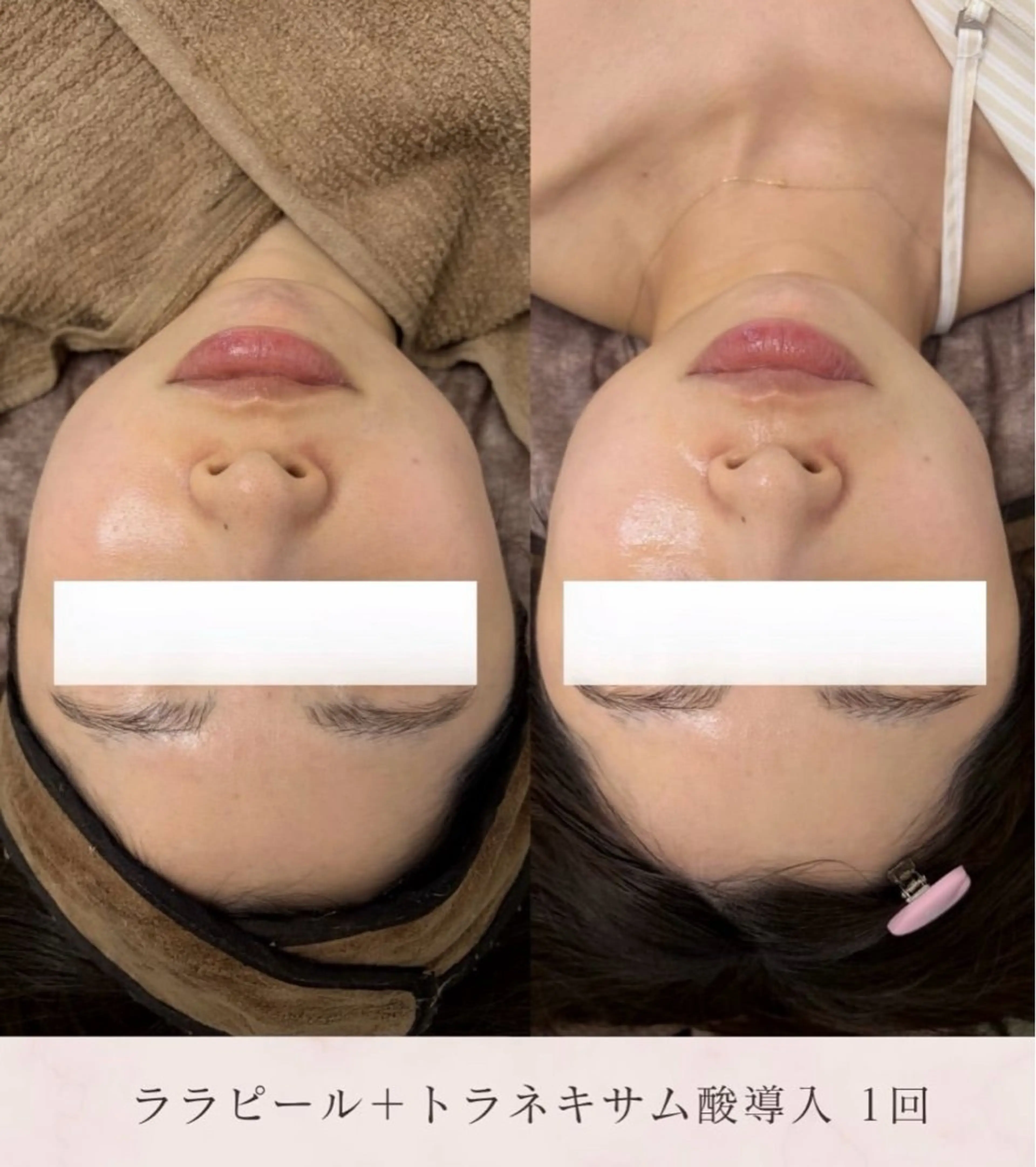 エステ 看護師が施術する美容 ナスサロshokoのエステ・リラクイメージ