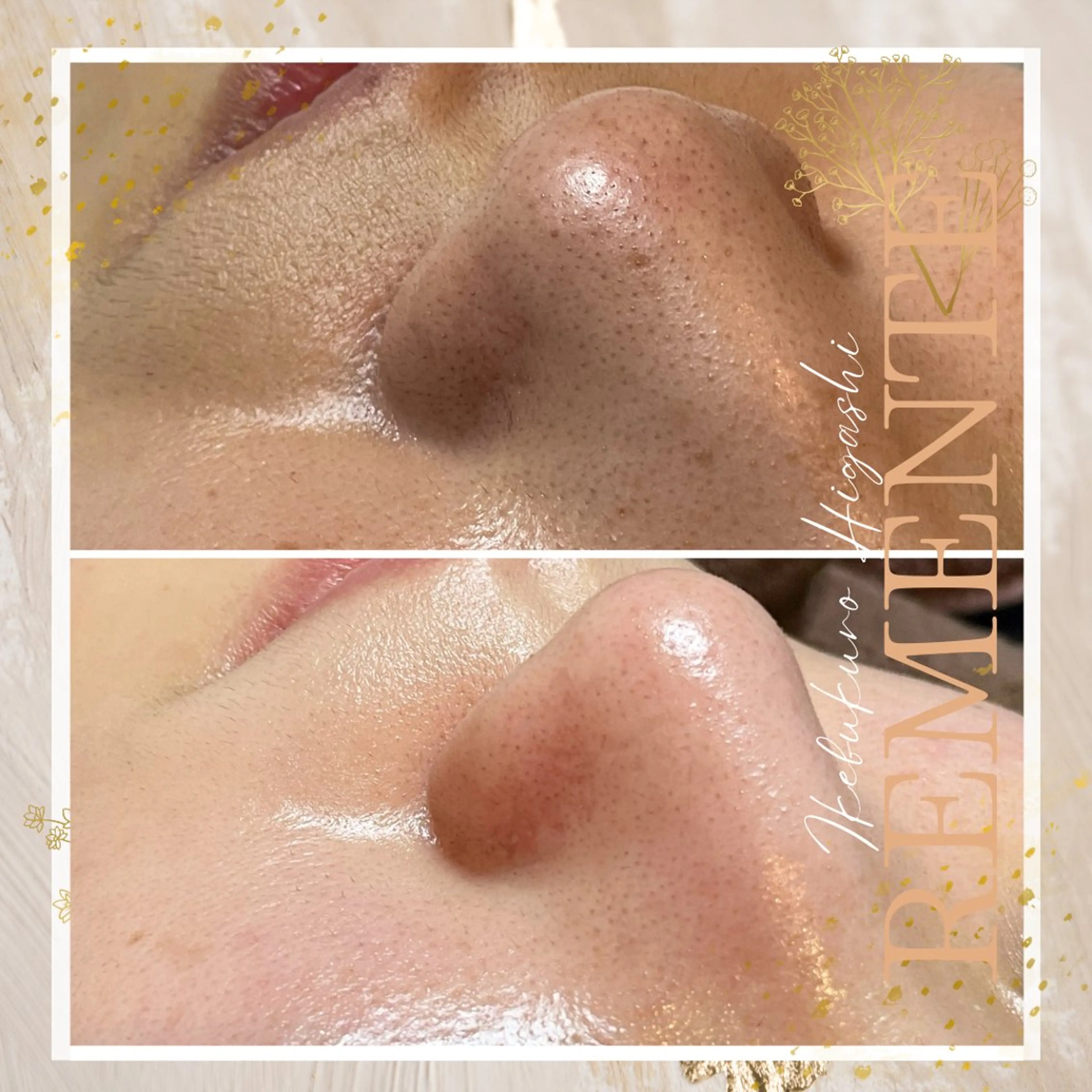 メンズ エステ CHARMER 韓国式美肌サロンの眉毛・アイブロウイメージ