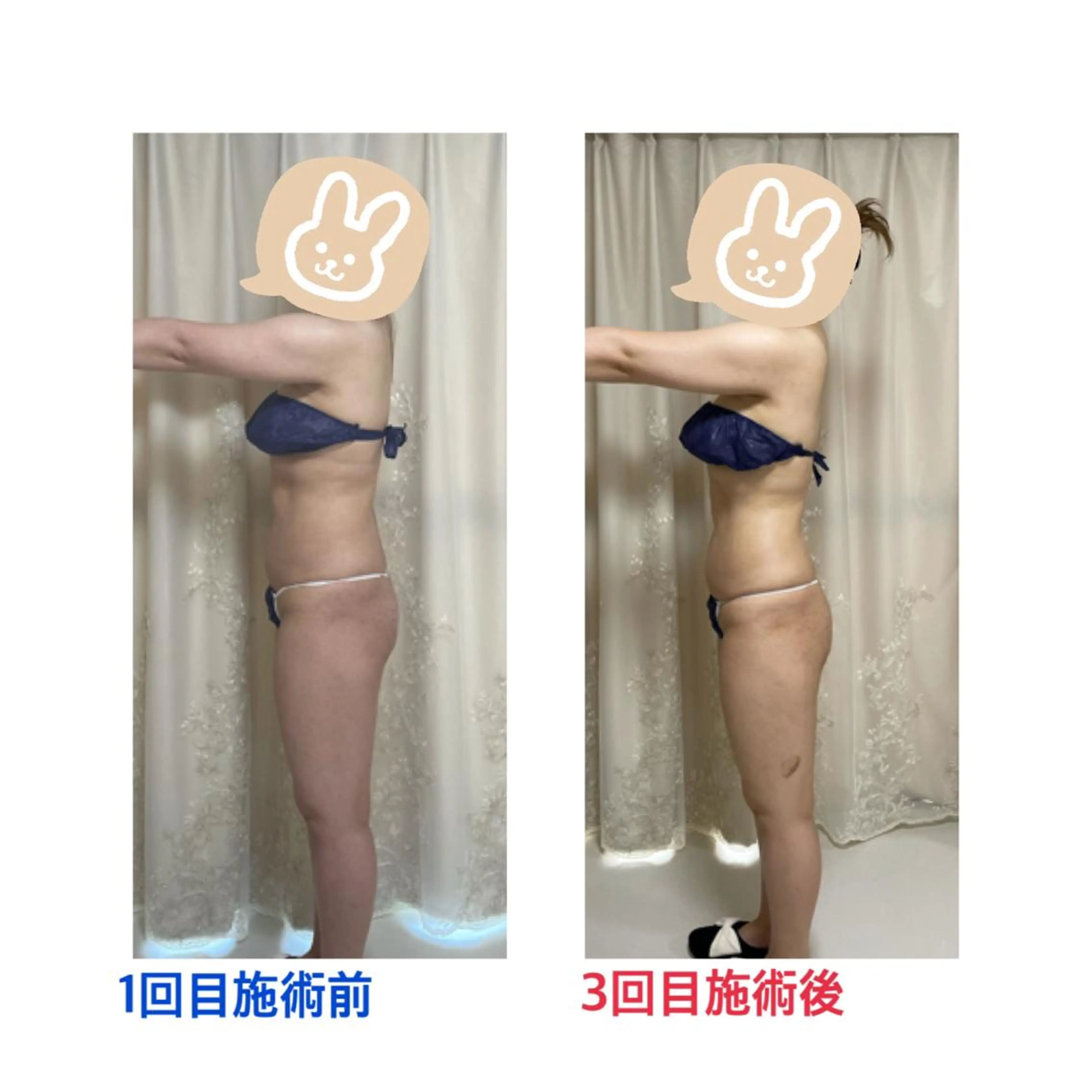 プライベートサロン moyoのエステ・リラクイメージ