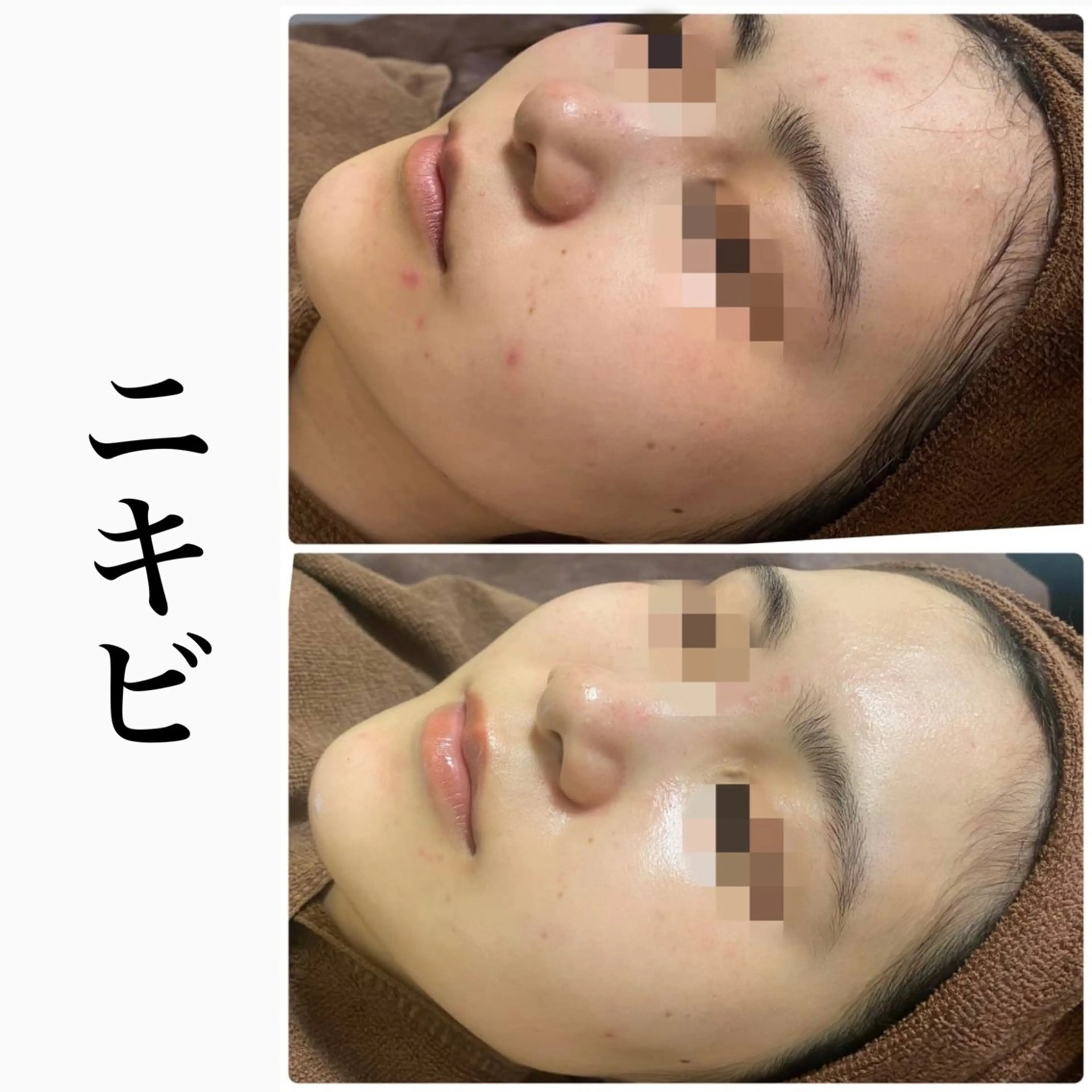 その他 ハーブピーリング専門 BIOPLUS+川崎のエステ・リラクイメージ