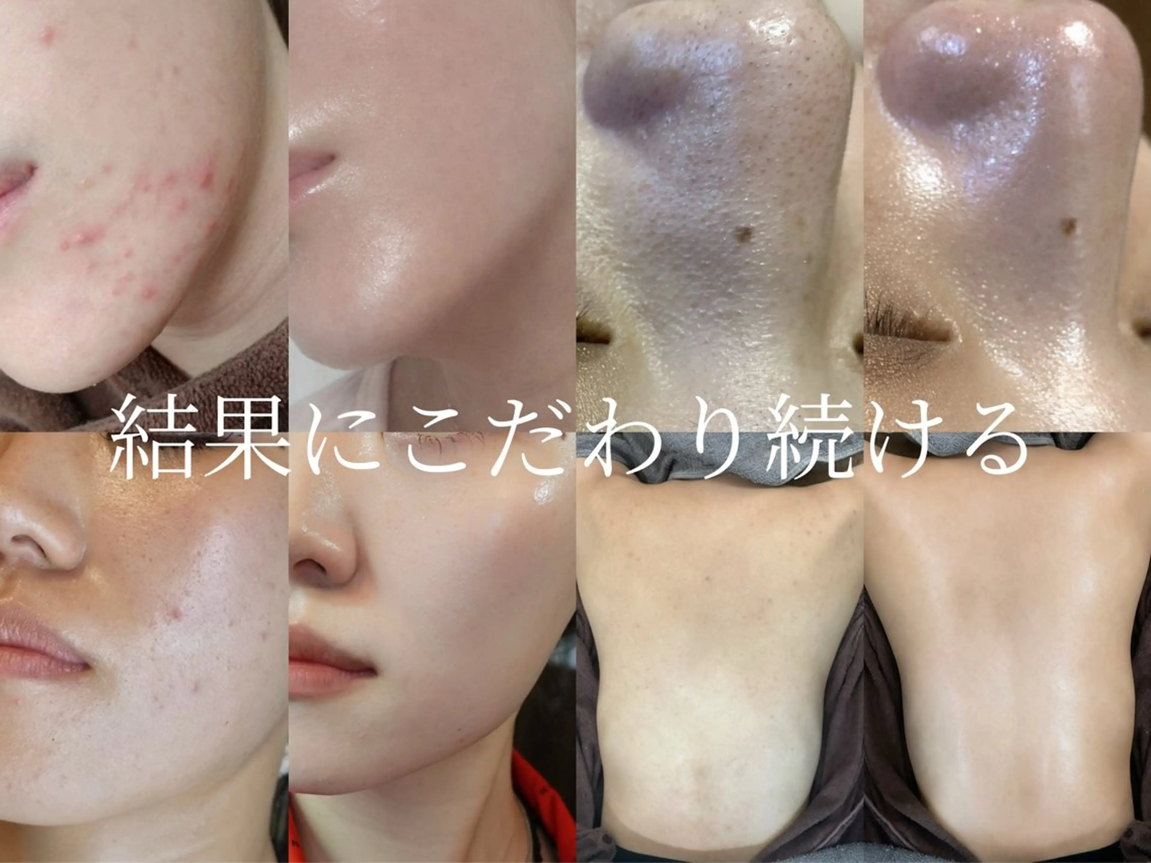 エステ foi sayaのエステ・リラクイメージ