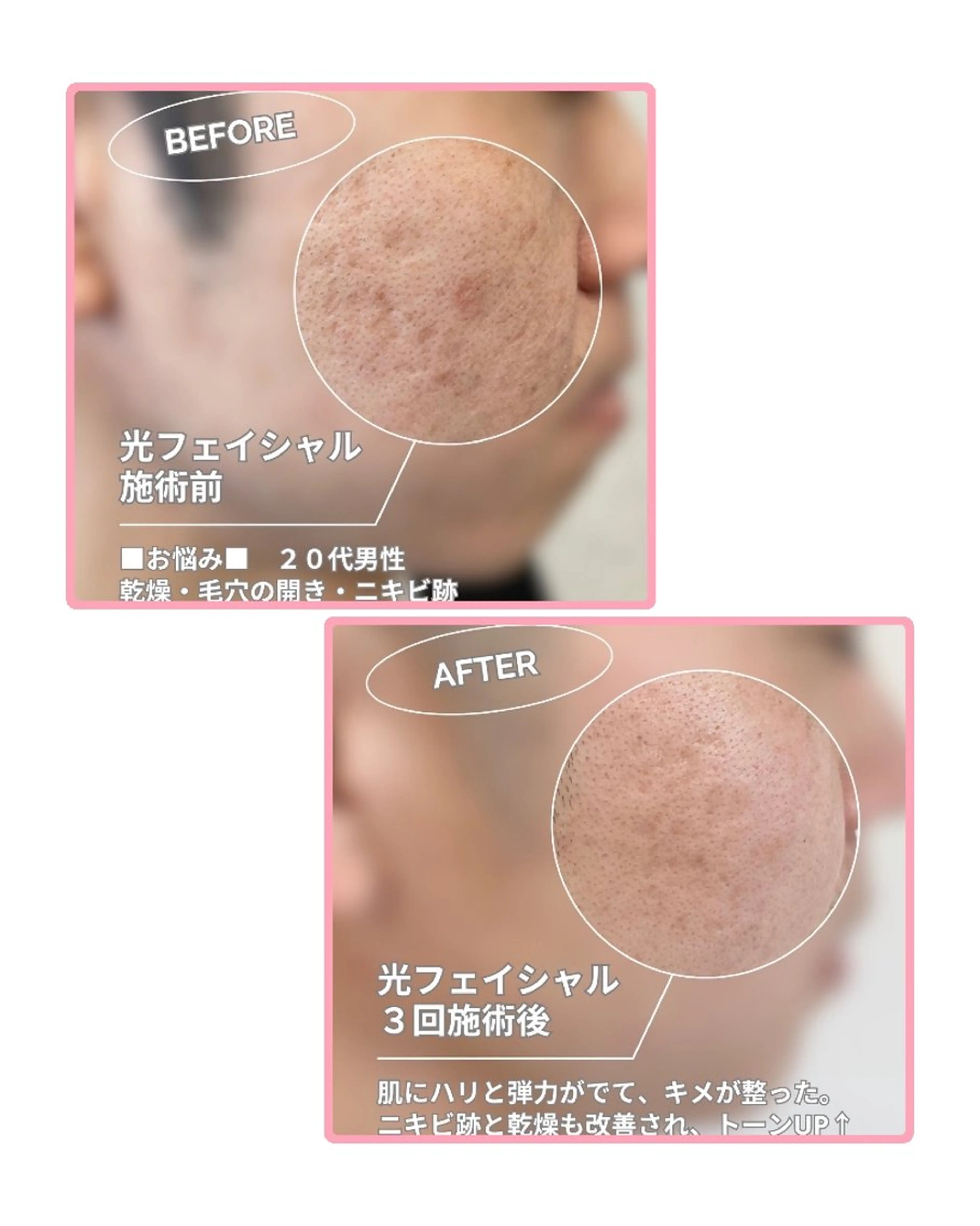 メンズ エステ salonde ReGodのエステ・リラクイメージ