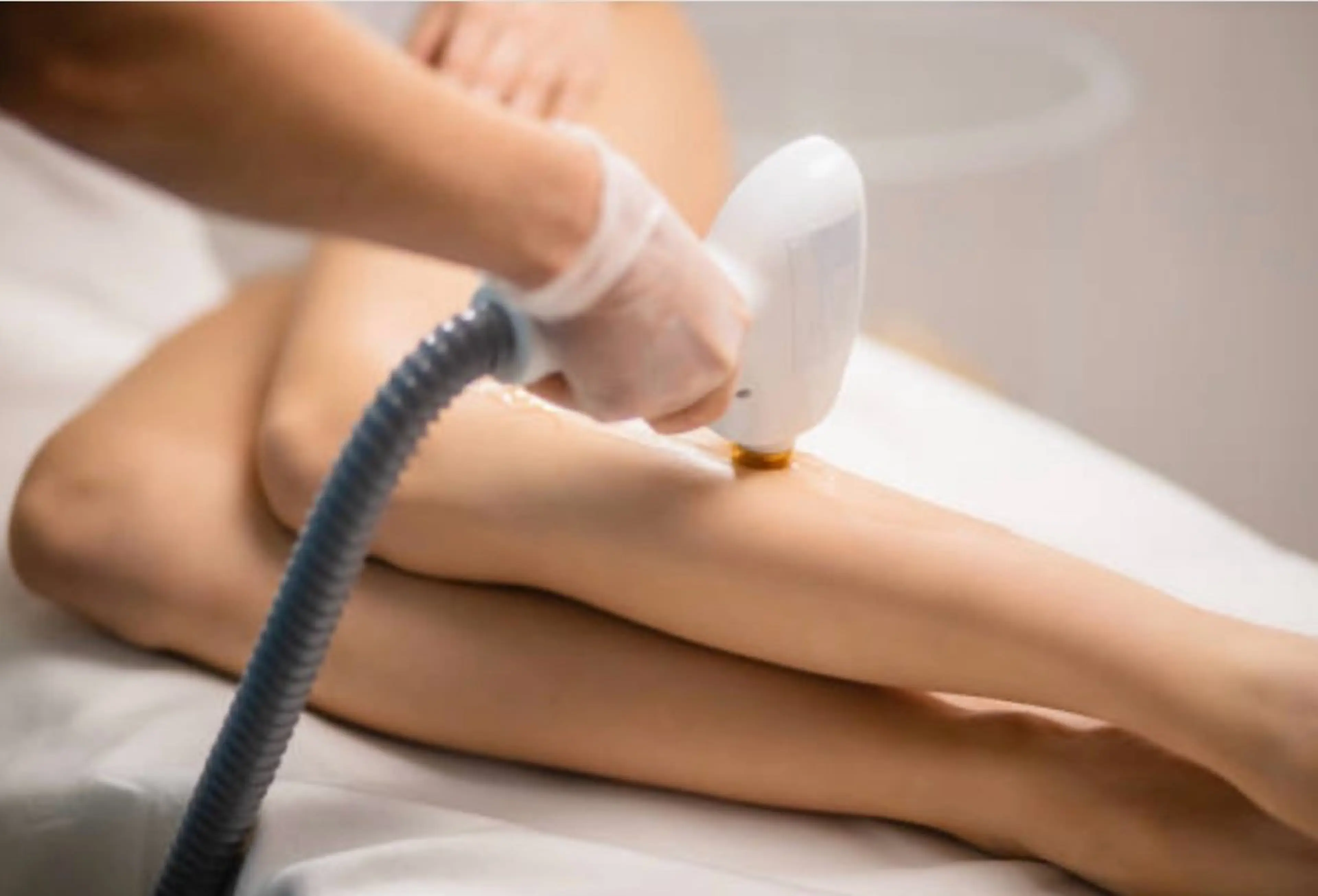 ✨光脱毛ケアコース✨VIO一箇所光脱毛＋デコルテ同時ケア✨の写真