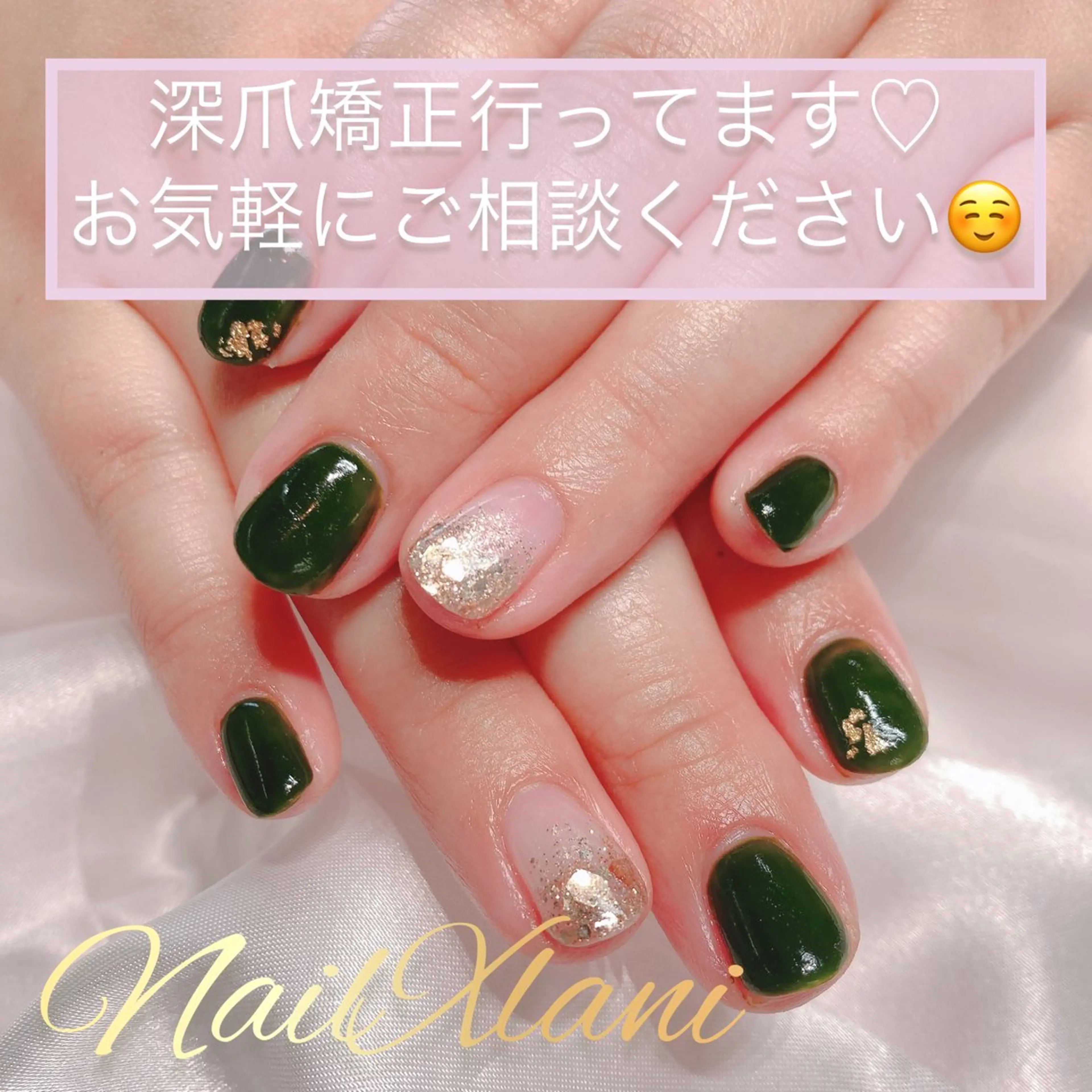 ネイル Nail×Lani 深爪矯正対応◎のネイルデザイン