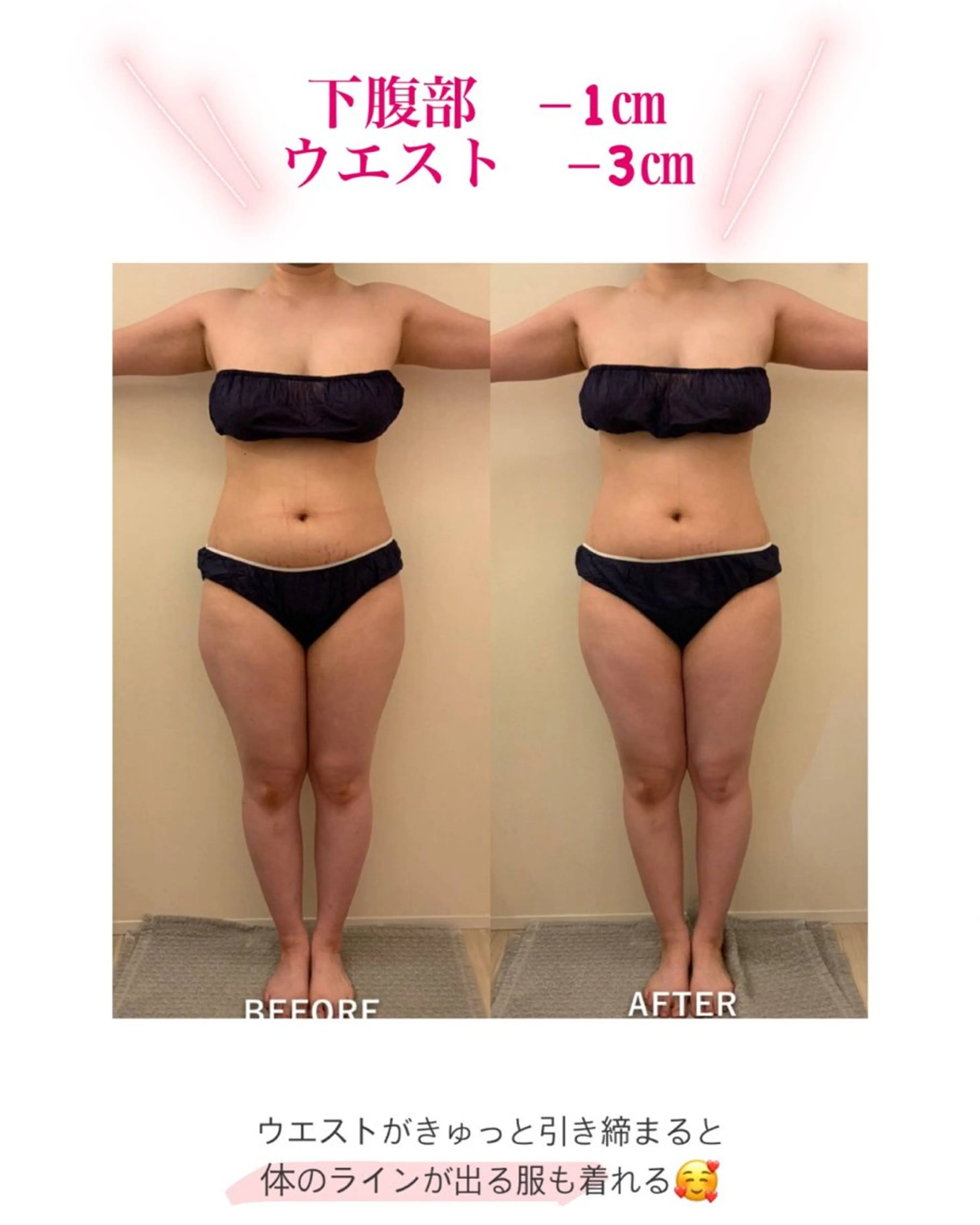 産後ダイエット−9㎏ Pourvous結衣のエステ・リラクイメージ