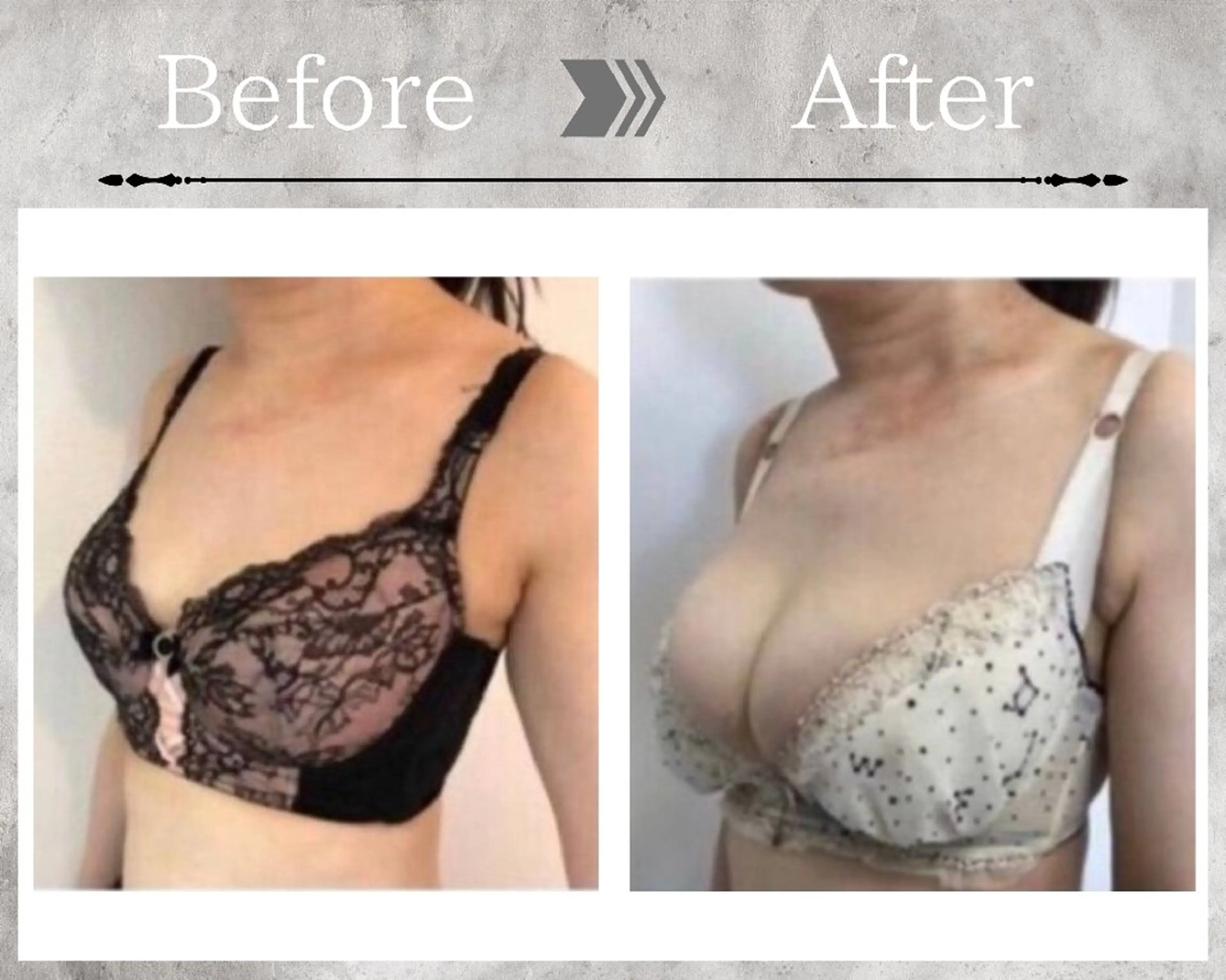 【✨️大人気モニター募集✨️】全身施術３回コース🩵の写真