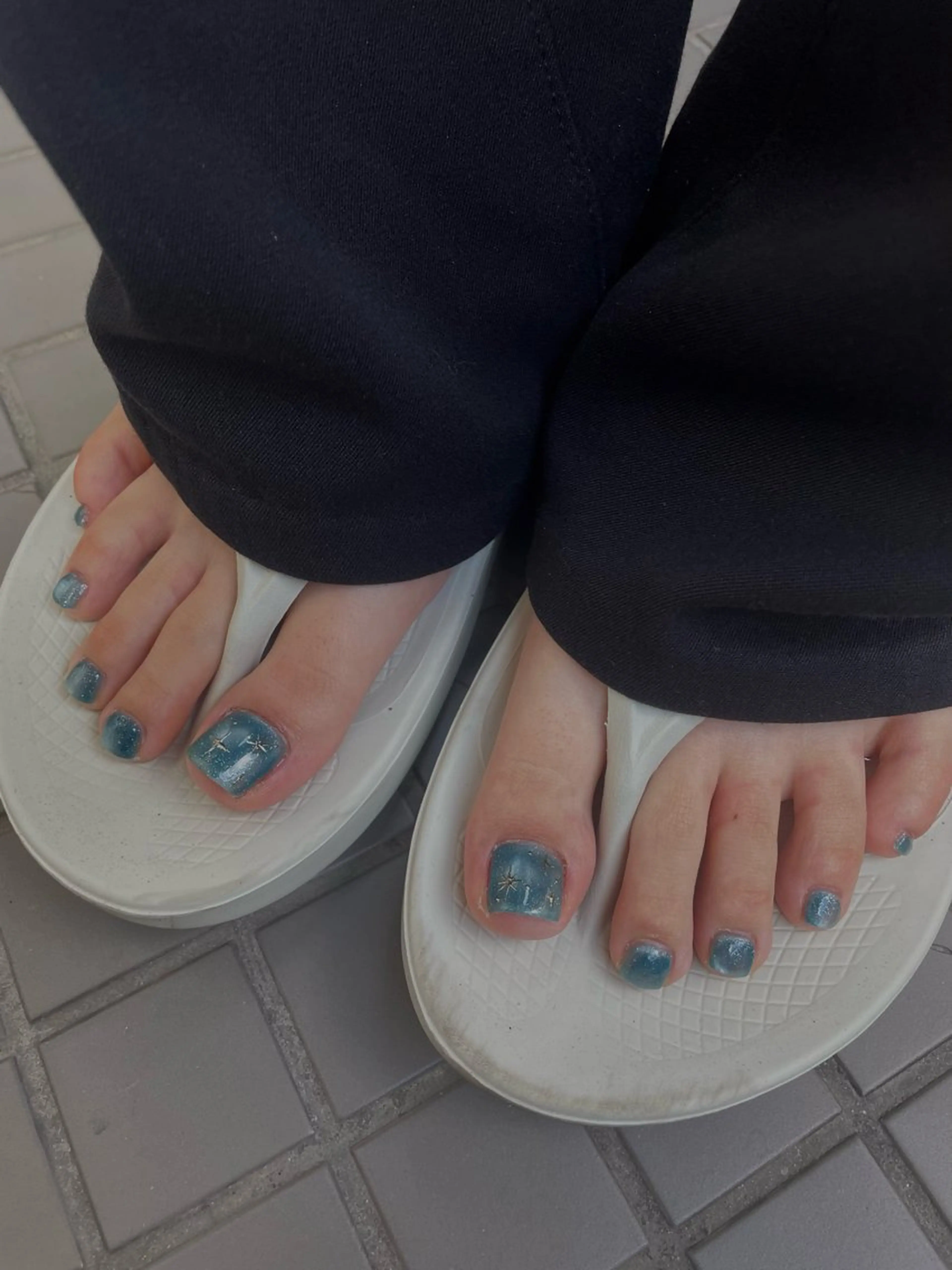 親指2本アートコース 〔オフ込〕の写真