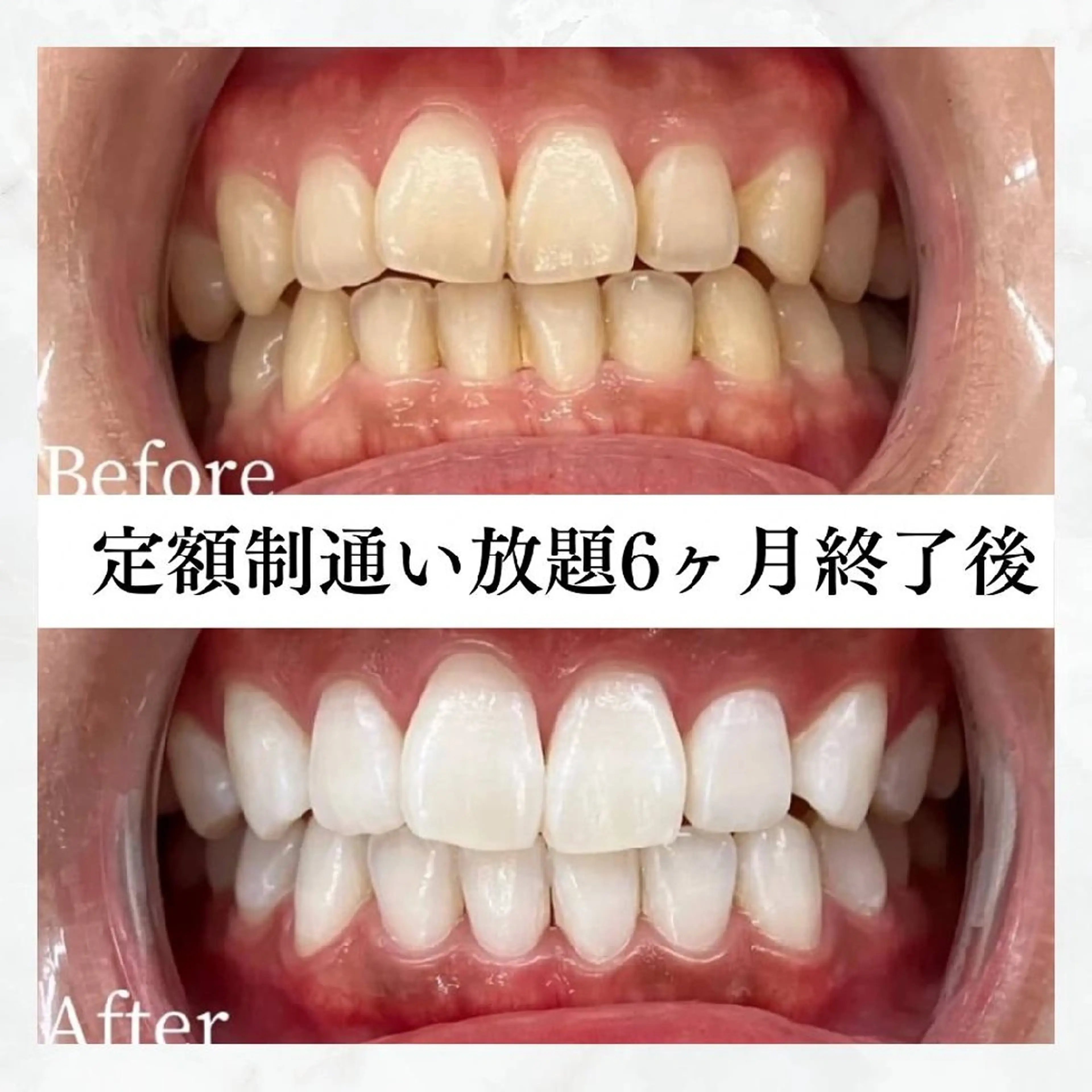 メンズ セルフホワイトニング WHITE福岡博多店のエステ・リラクイメージ