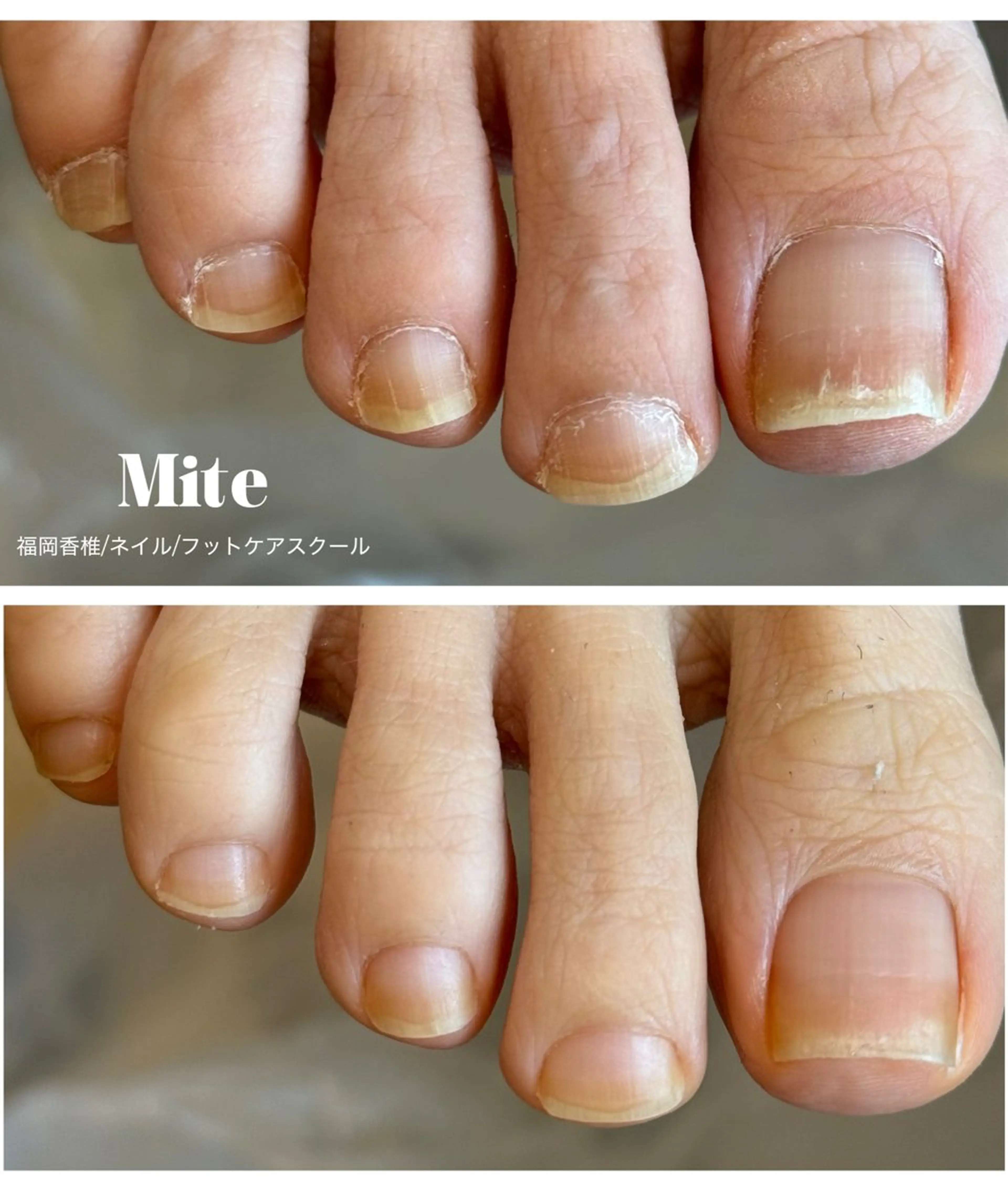 ネイル フットネイル フットネイル Mite ミテのネイルデザイン