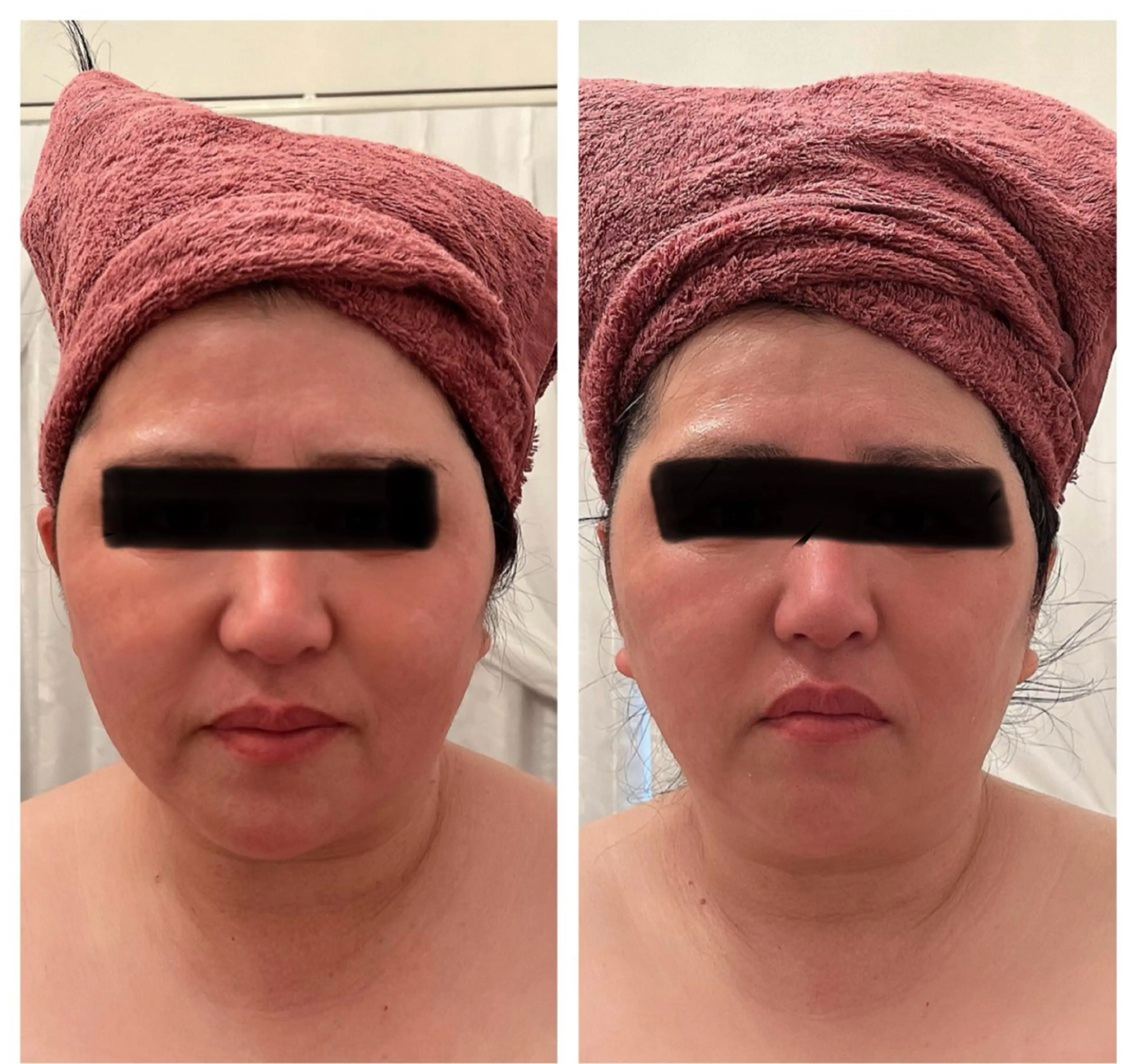 Relative ララティブのエステ・リラクイメージ