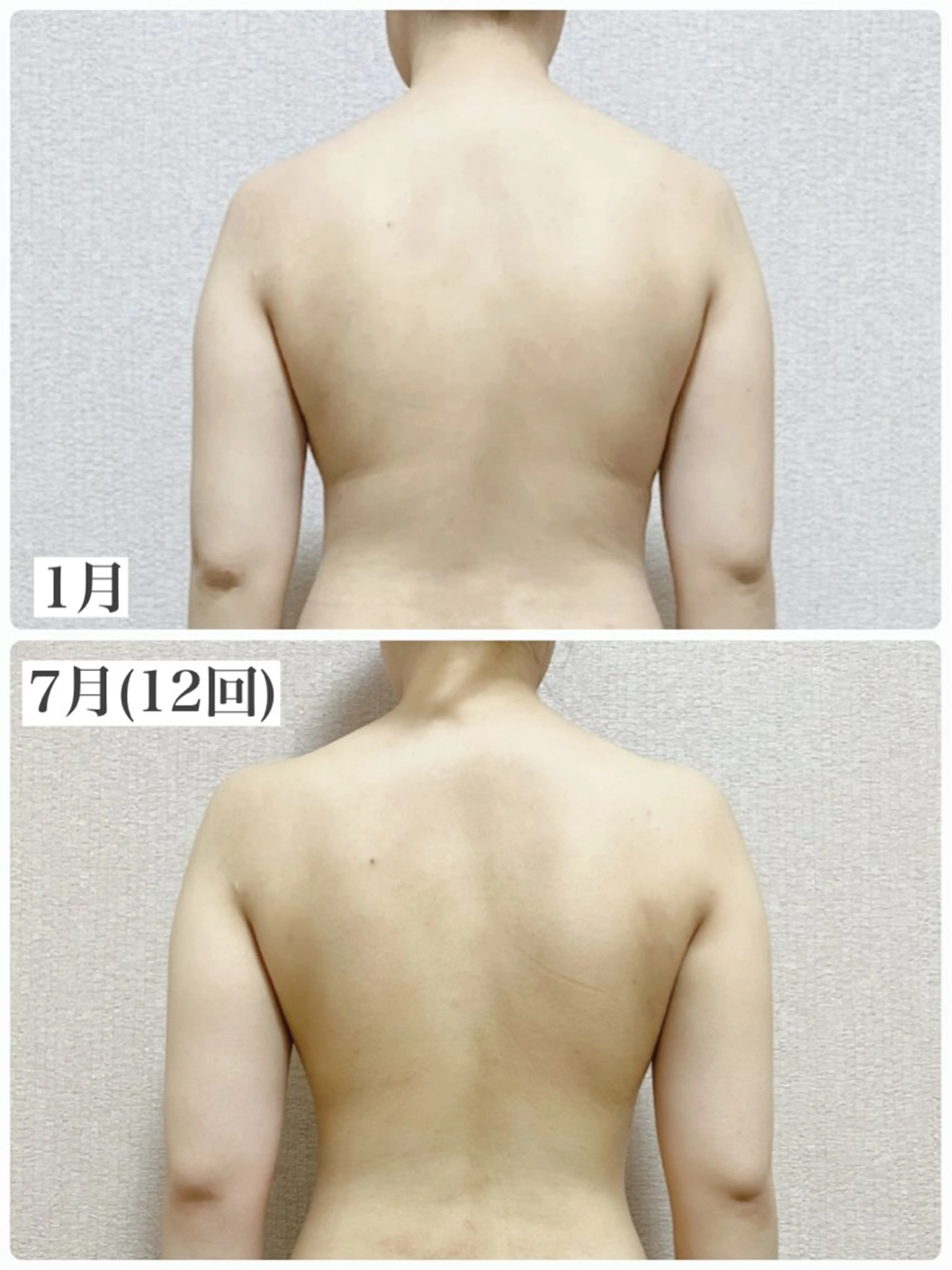 mooi【モーイ】所属・【北堀江】 痩身/小顔　mooiのエステ・リラクイメージ