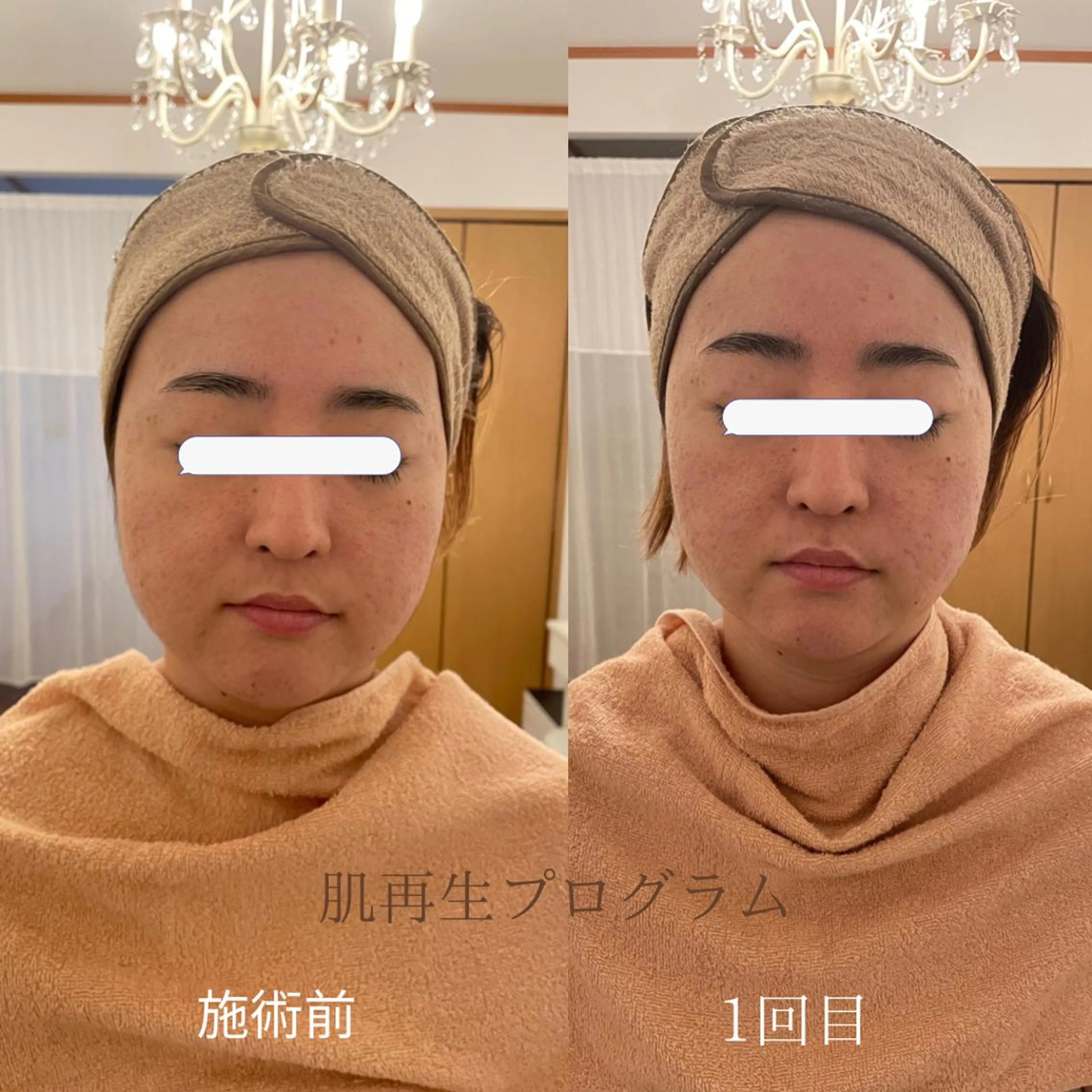 MA CHÉRIE所属・体質別痩身&小顔 MA CHÉRIEのエステ・リラクイメージ