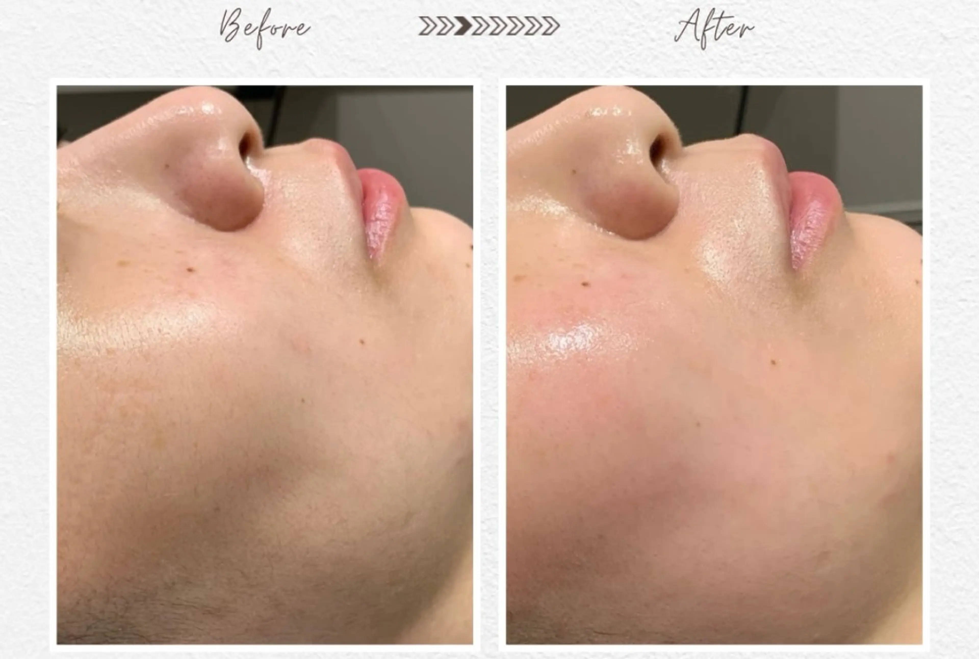 Lala Beautyのエステ・リラクイメージ