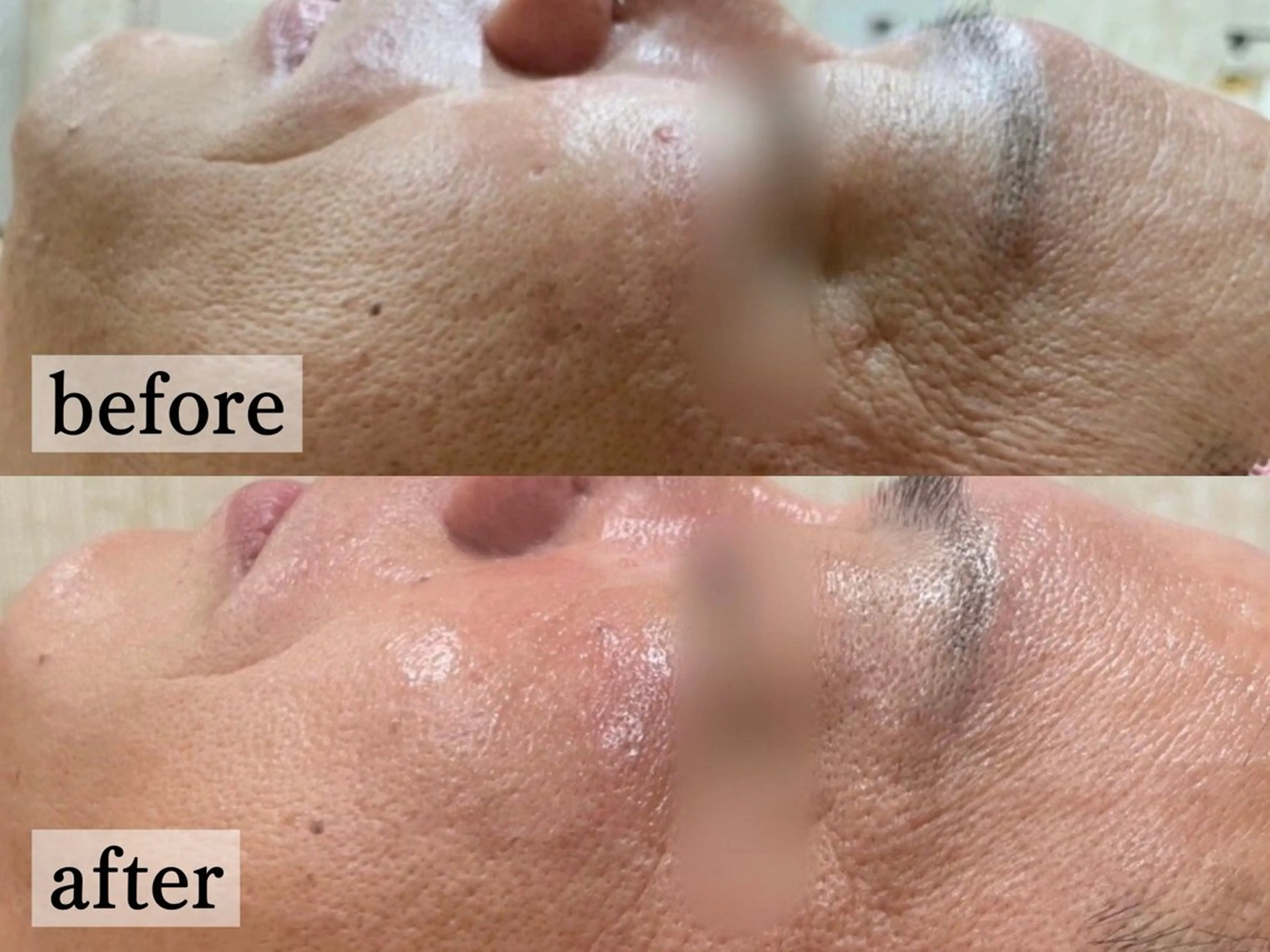 エステ フェイシャル/脱毛 ジョアアンジェ竹田のエステ・リラクイメージ