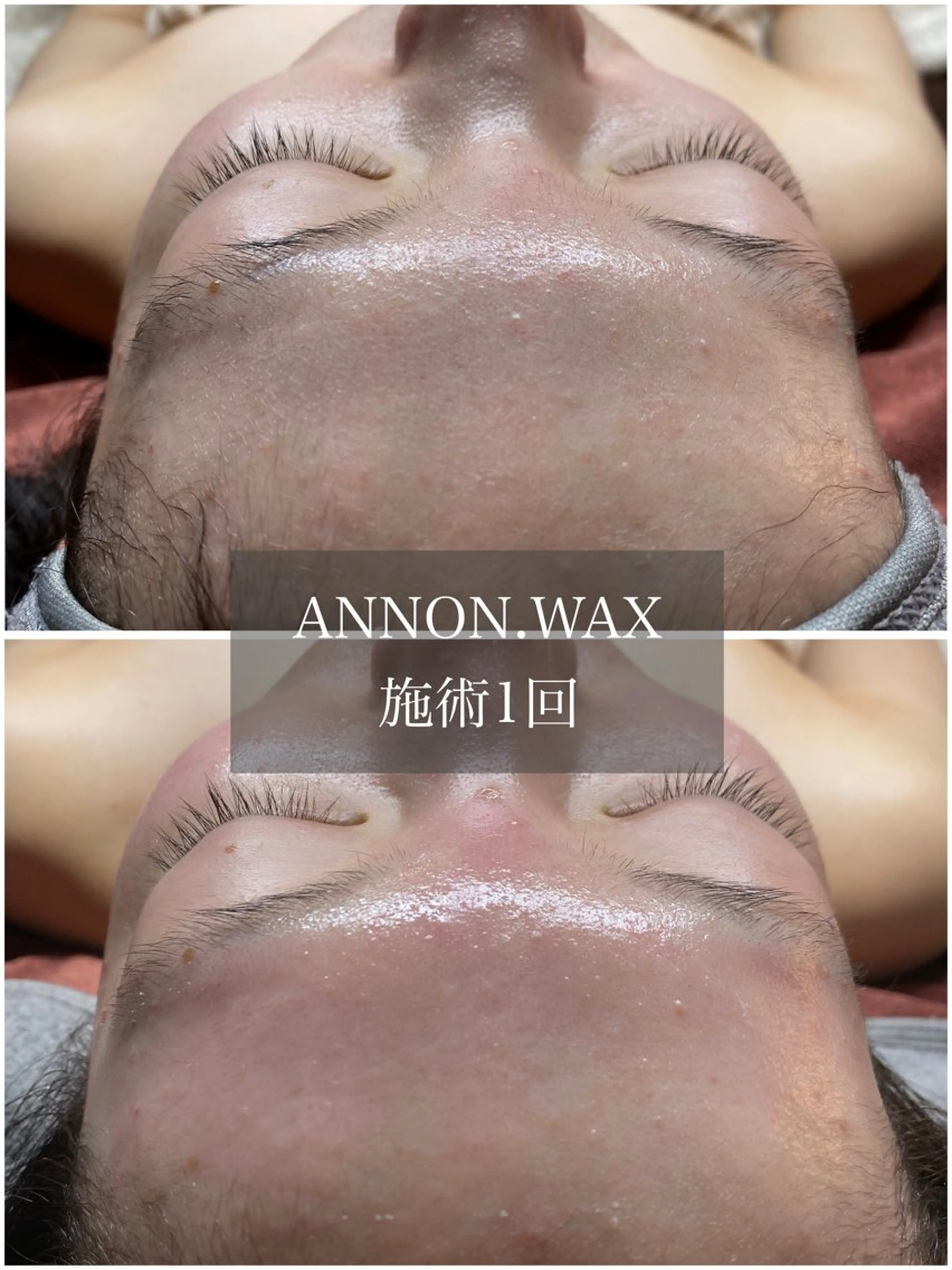 エステ 肌質改善ワックス専門 yukiのエステ・リラクイメージ