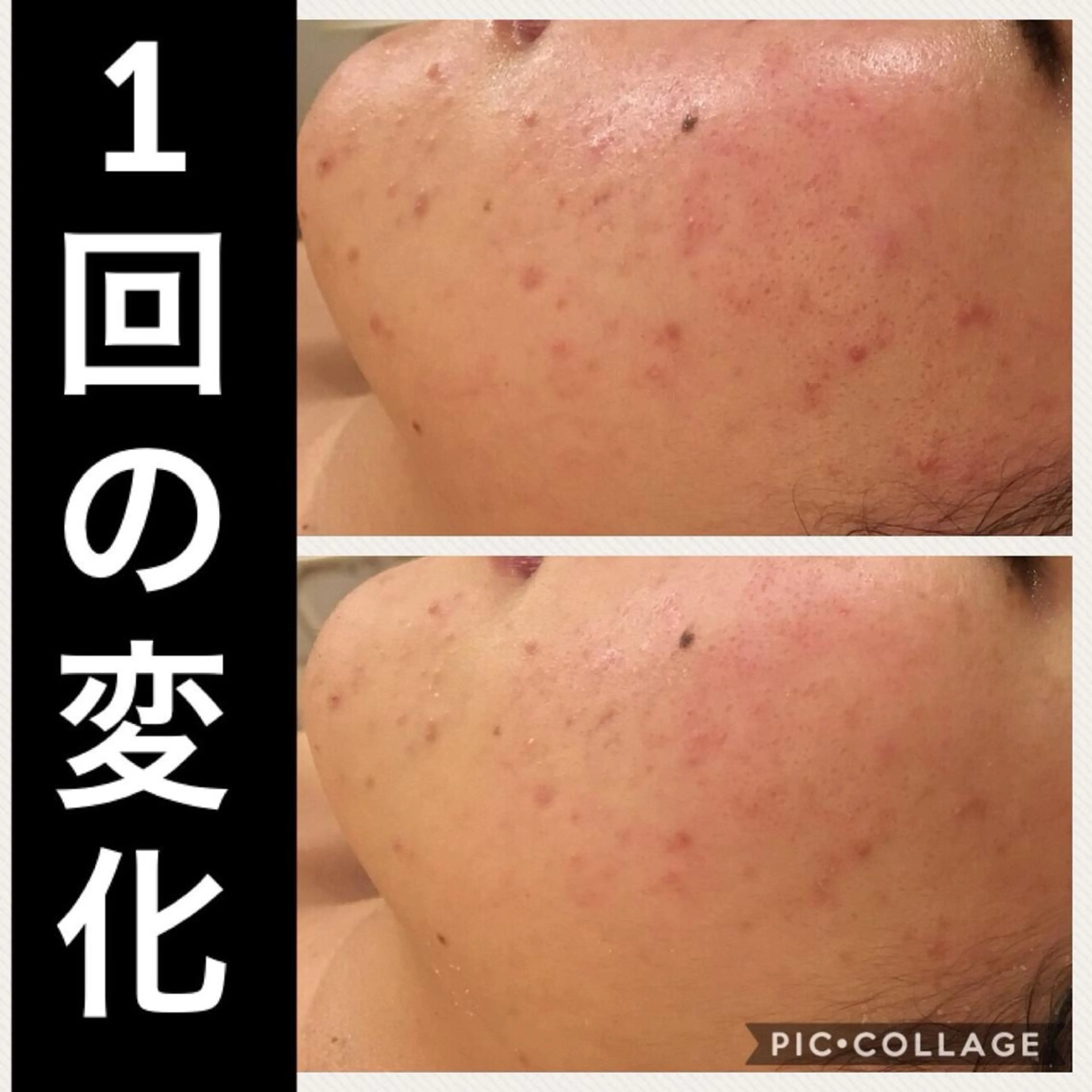 ミディアム パーマ ヘアアレンジ メンズ キッズ ネイル マツエク・マツパ ニキビ・肌質改善専門 ♡人生が変わるサロンのエステ・リラクイメージ