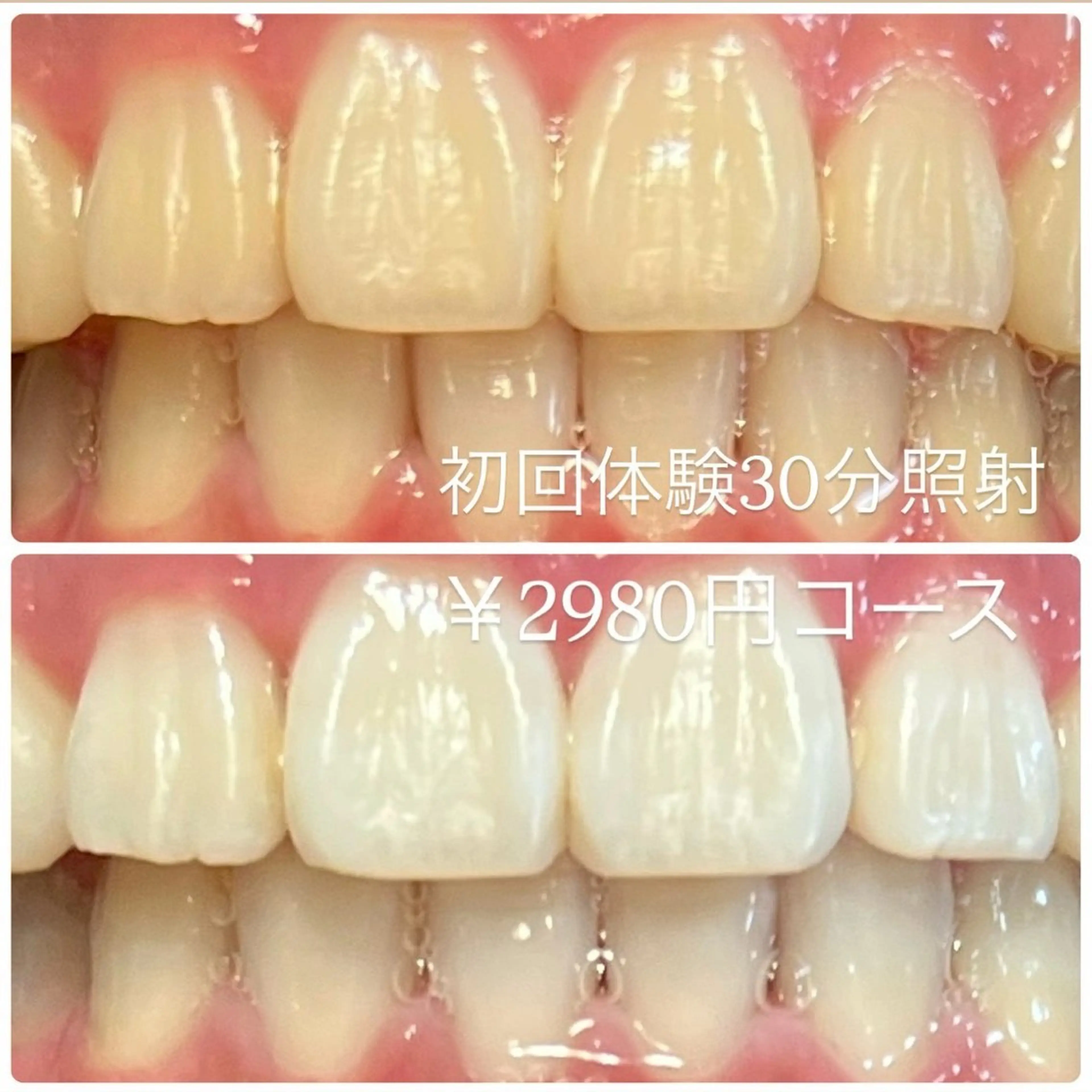 その他 ホワイトニングルーム 横浜店のその他イメージ