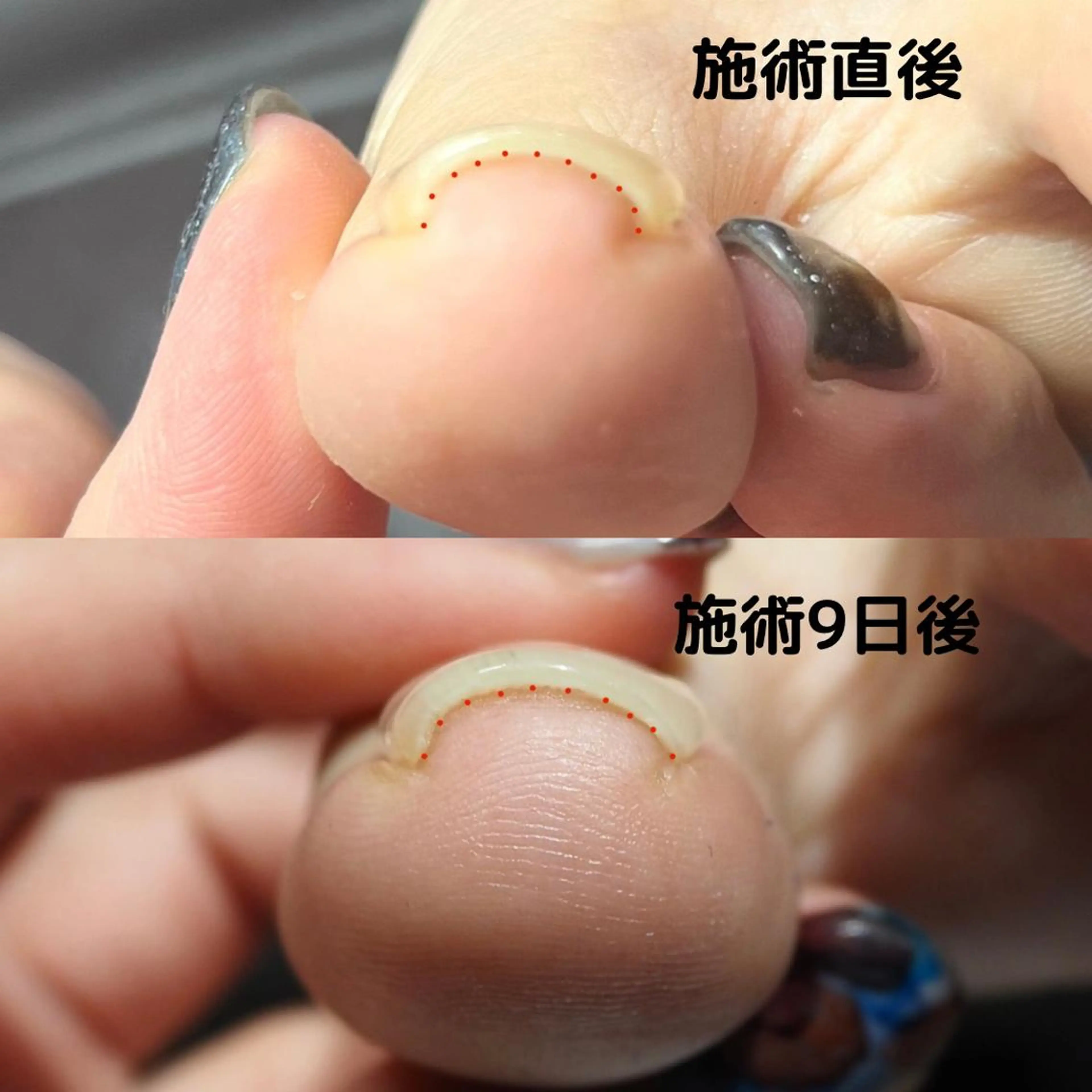 ネイル フットネイル Gatto(ガット) ヤマモトのネイルデザイン