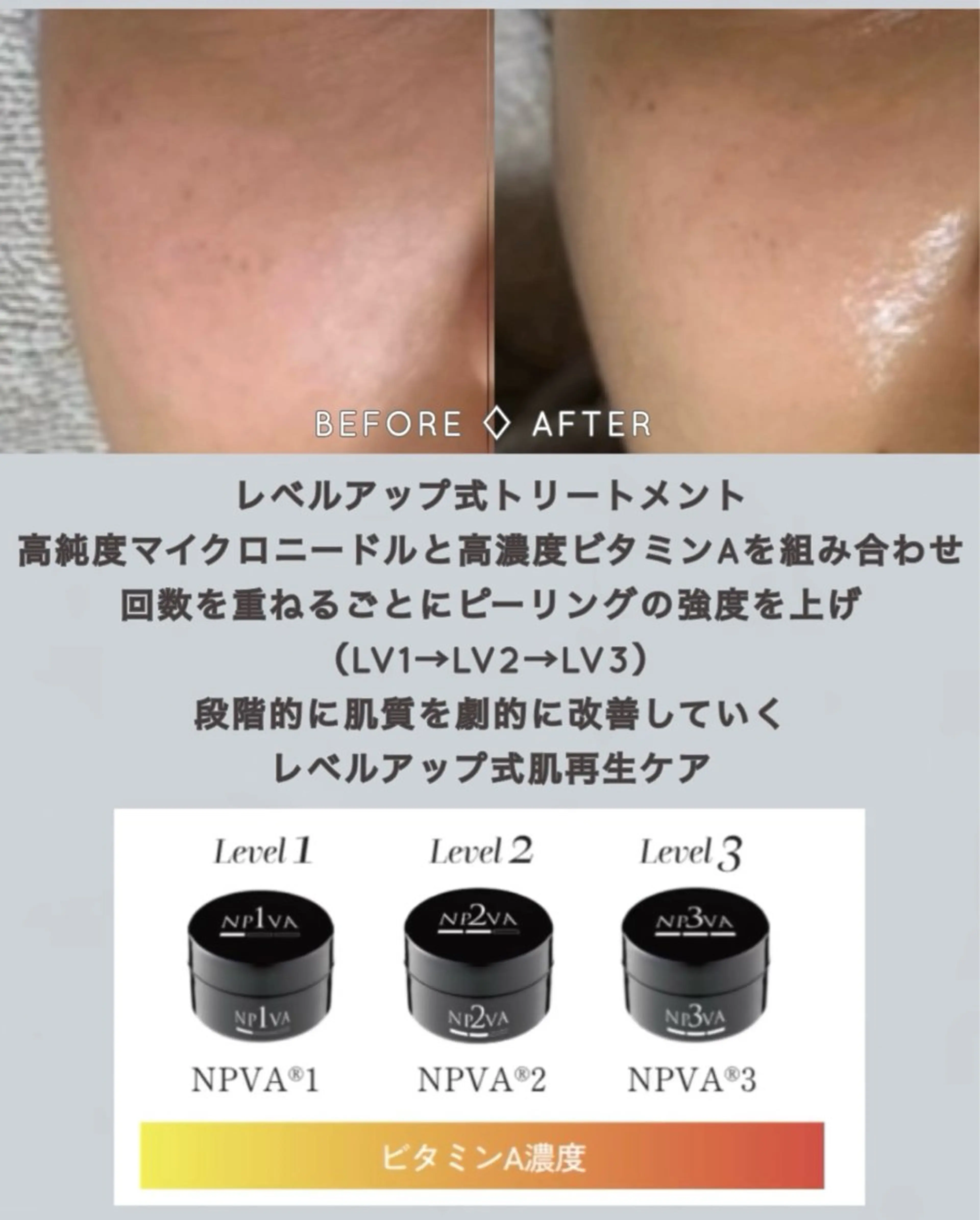 エステ ヴィーナス ビューティーのエステ・リラクイメージ