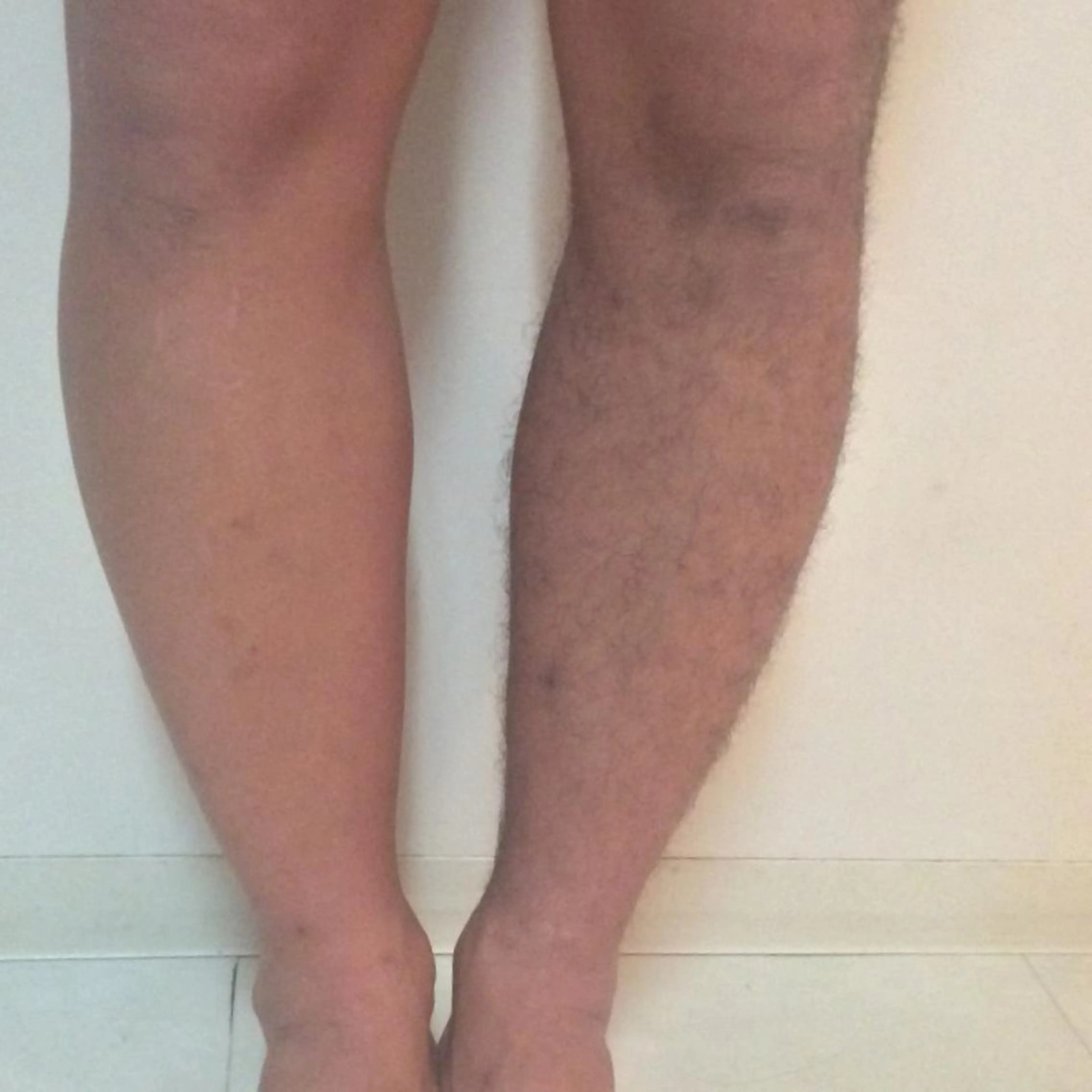 men's beauty Secret所属・永瀬 光のエステ・リラクイメージ