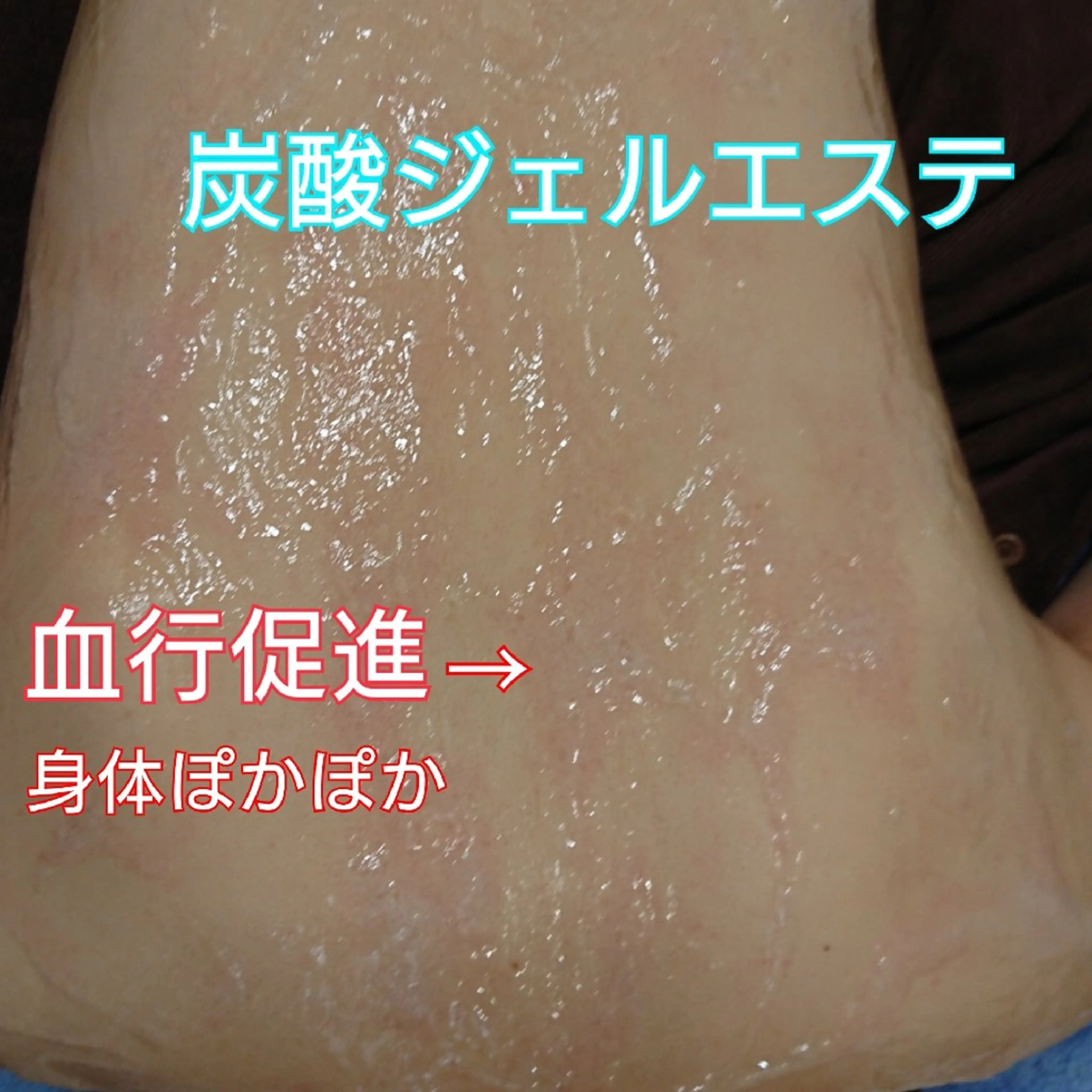 背中肉スッキリ❕【炭酸美容* 引き締め背中ケア】 ボディライン✨肩こり✨ニキビ跡✨の写真