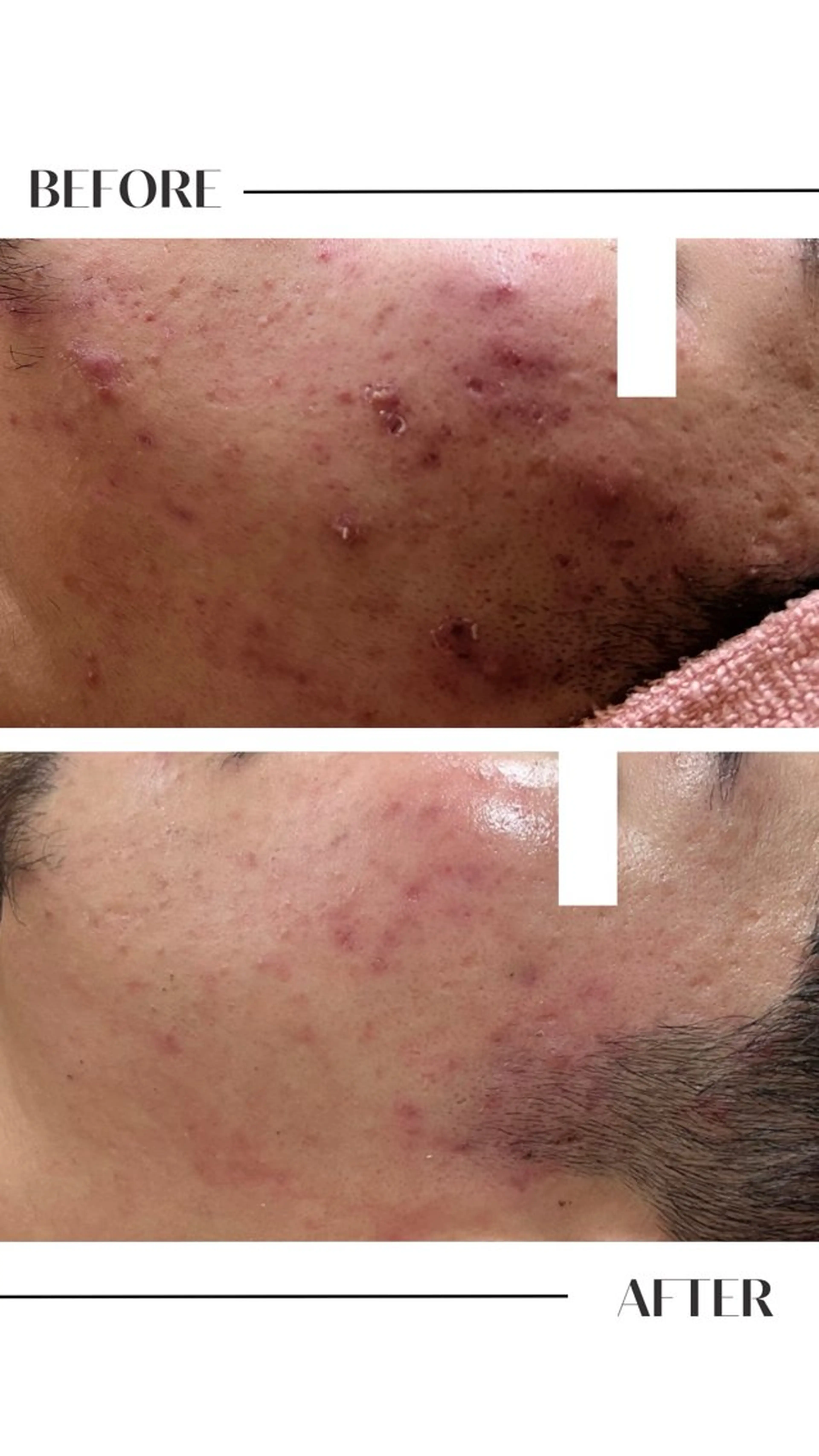 エステ フェイシャル/脱毛 ジョアアンジェ竹田のエステ・リラクイメージ