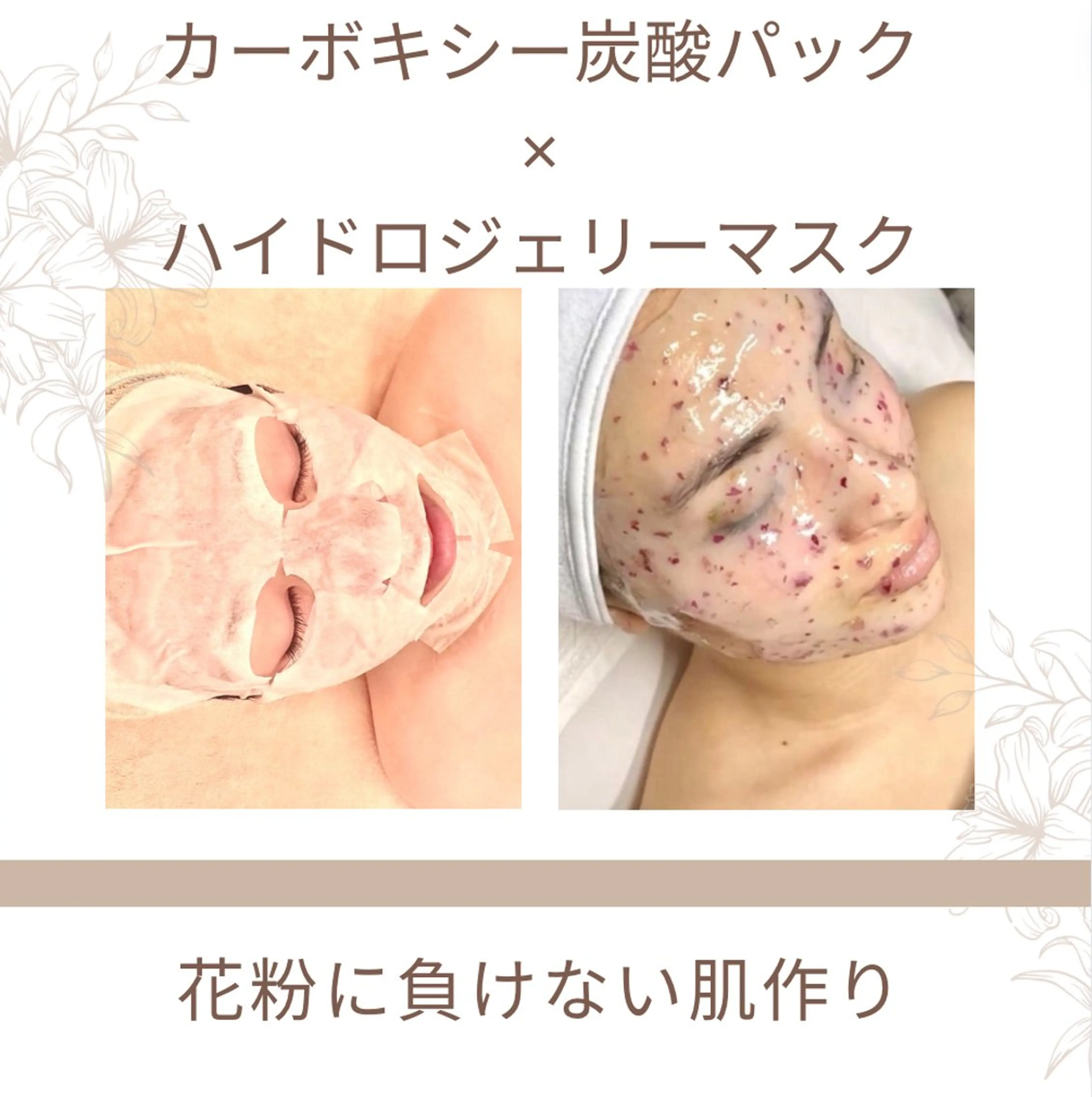 Lily luce 美骨小顔矯正のその他イメージ