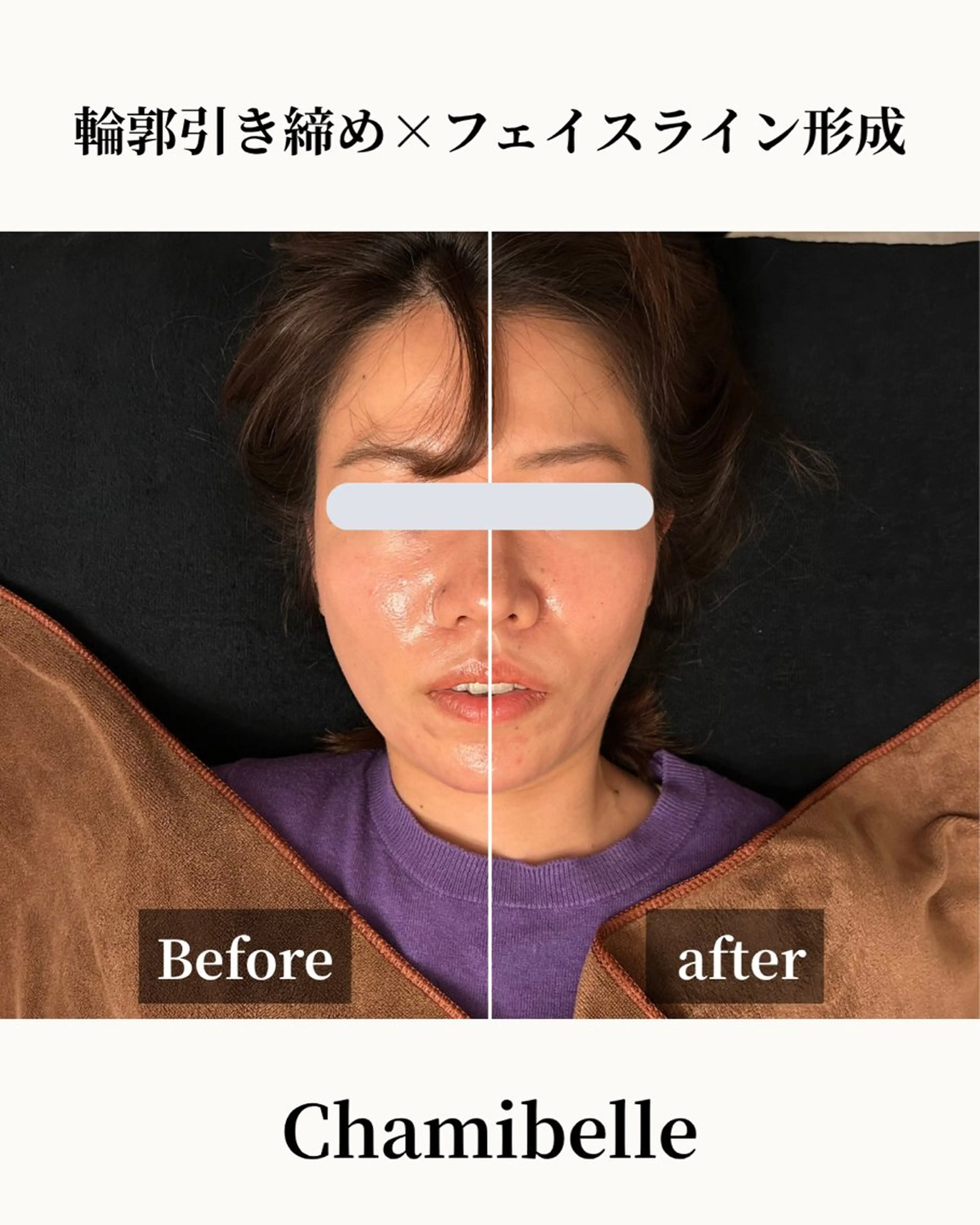 美容鍼灸サロン Chamibelleのエステ・リラクイメージ